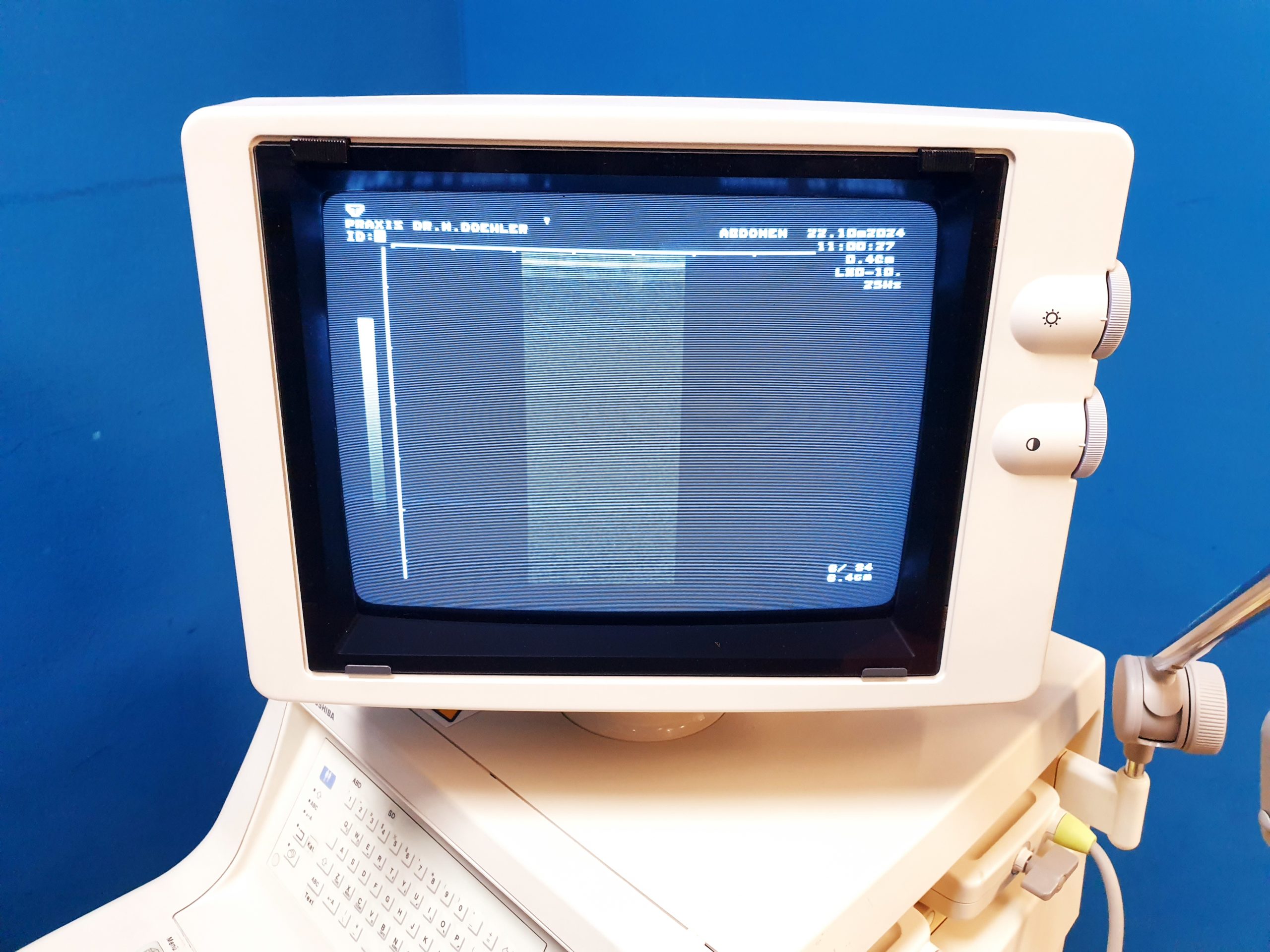 Toshiba Just Vision 400 Justvision 400 SSA-325 + Konvex + Linear – Bild 13