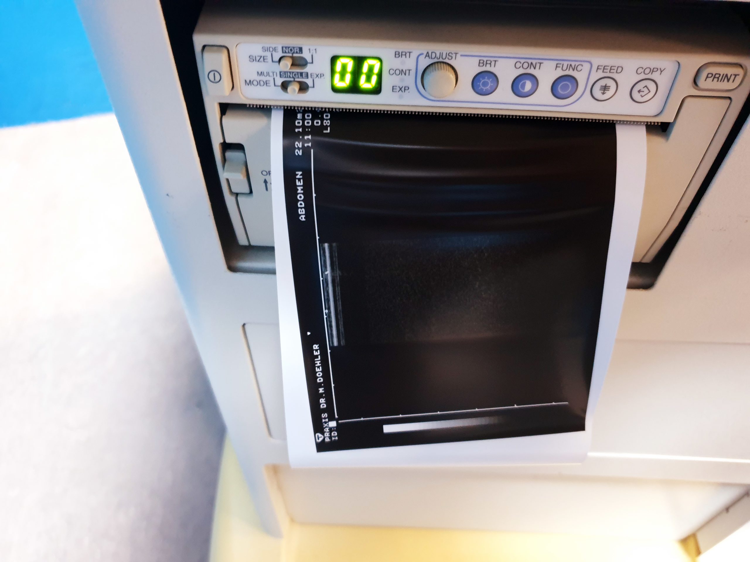 Toshiba Just Vision 400 Justvision 400 SSA-325 + Konvex + Linear – Bild 8