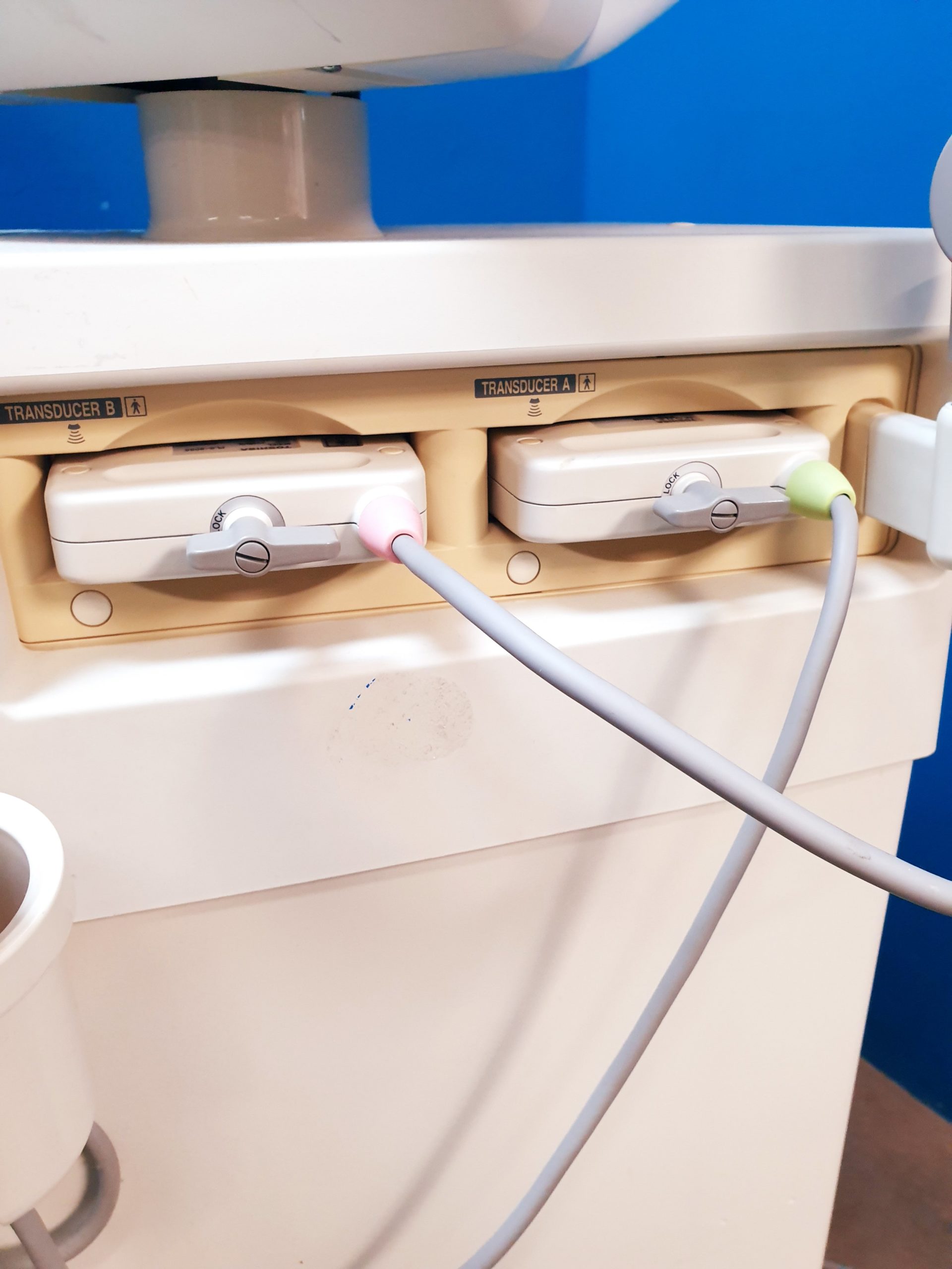 Toshiba Just Vision 400 Justvision 400 SSA-325 + Konvex + Linear – Bild 10