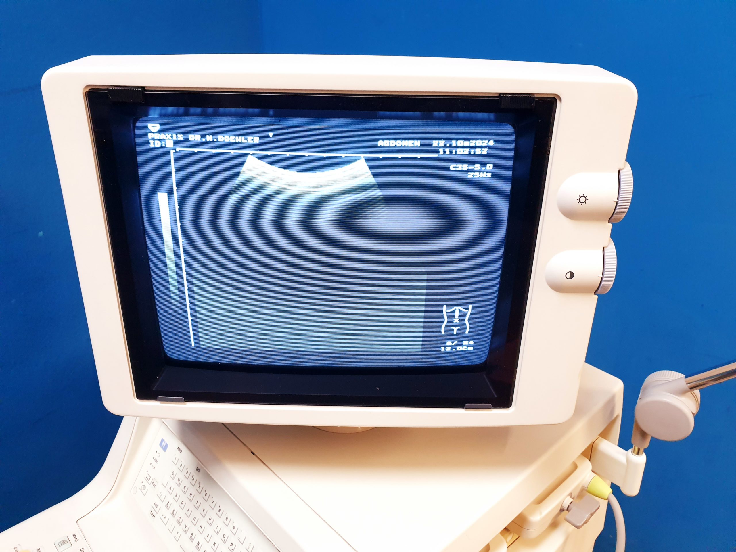 Toshiba Just Vision 400 Justvision 400 SSA-325 + Konvex + Linear – Bild 2