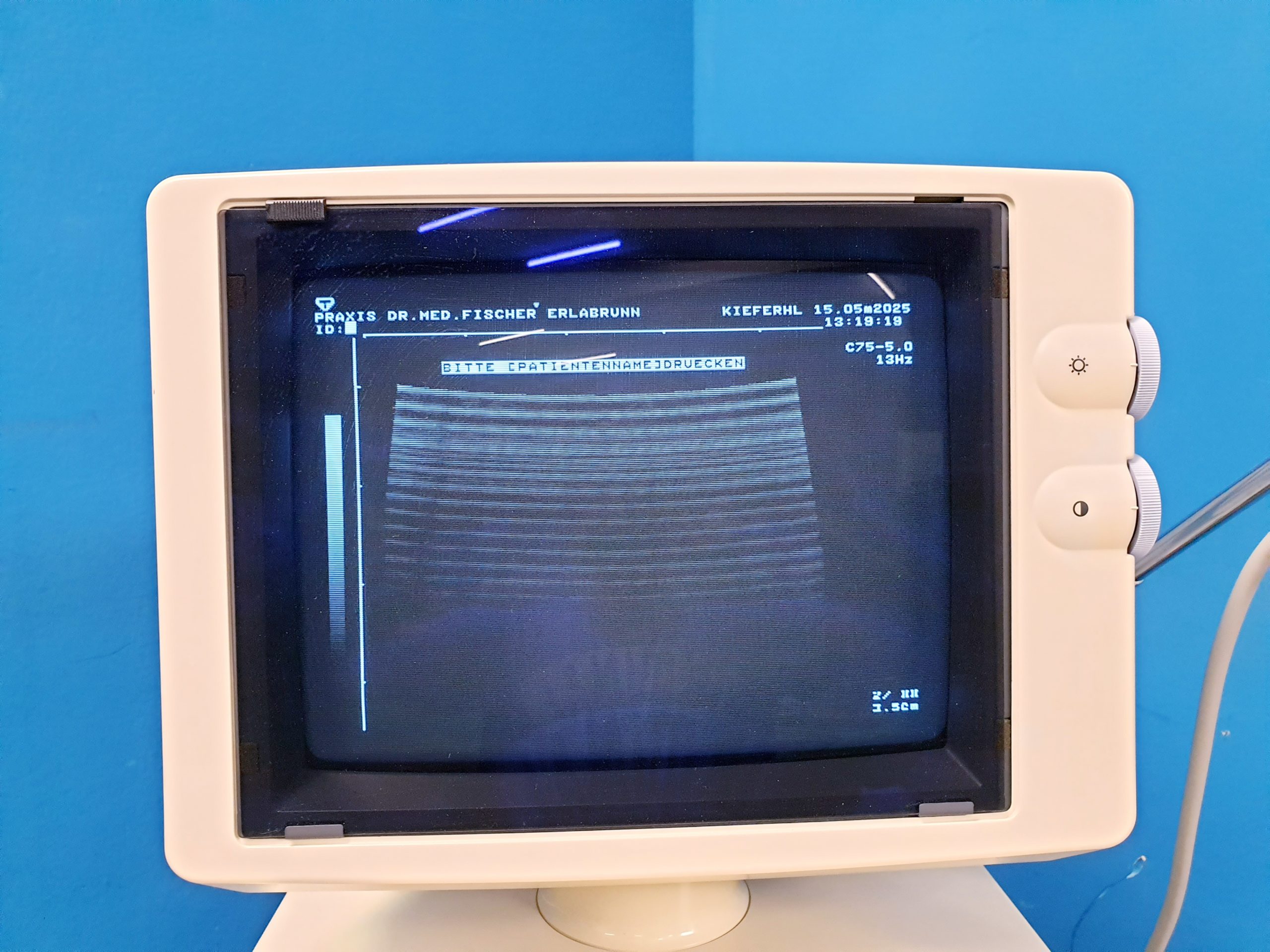 Toshiba Just Vision 400 Justvision 400 SSA-325 + Konvex + Linear – Bild 30