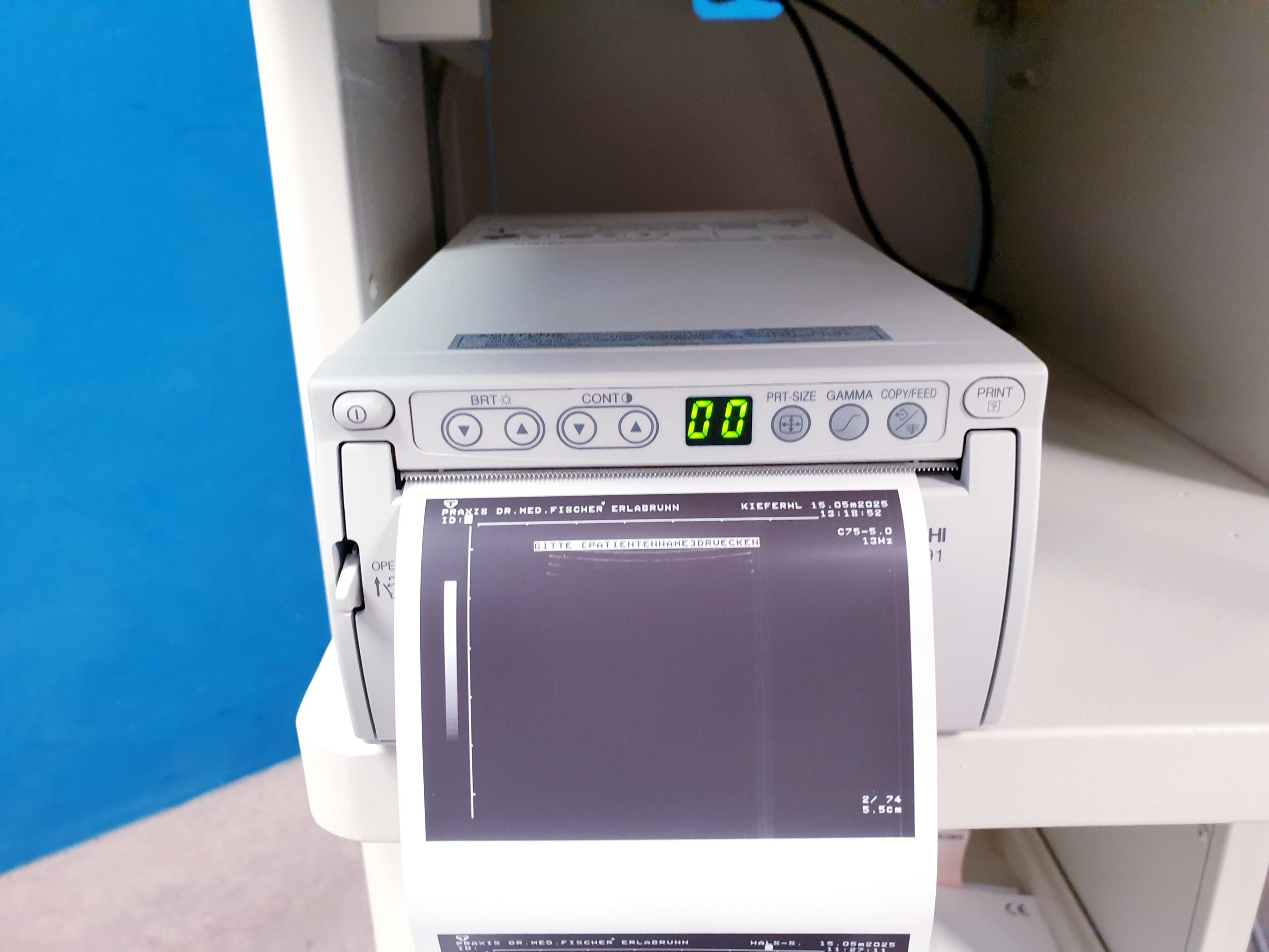 Toshiba Just Vision 400 Justvision 400 SSA-325 + Konvex + Linear – Bild 31