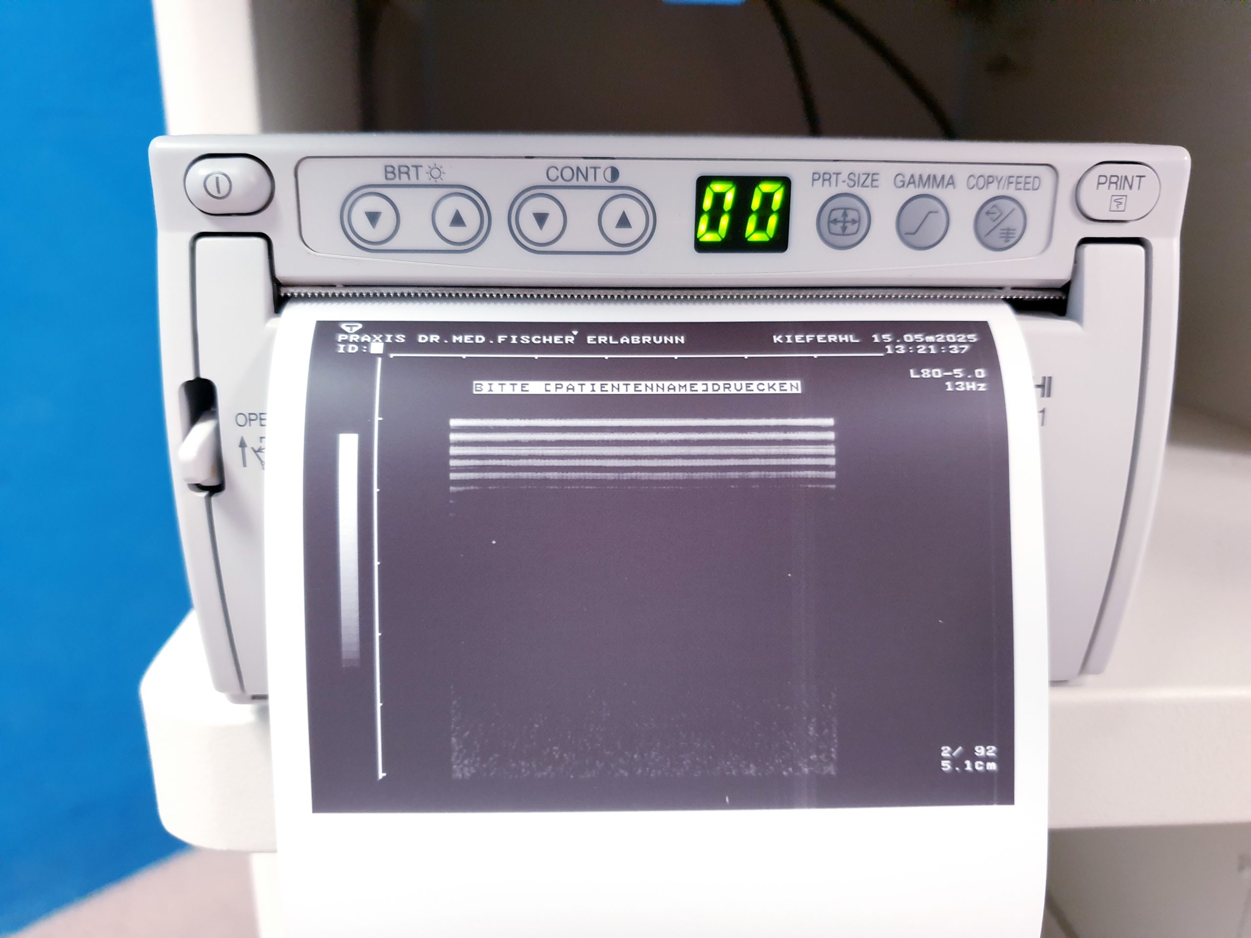 Toshiba Just Vision 400 Justvision 400 SSA-325 + Konvex + Linear – Bild 36