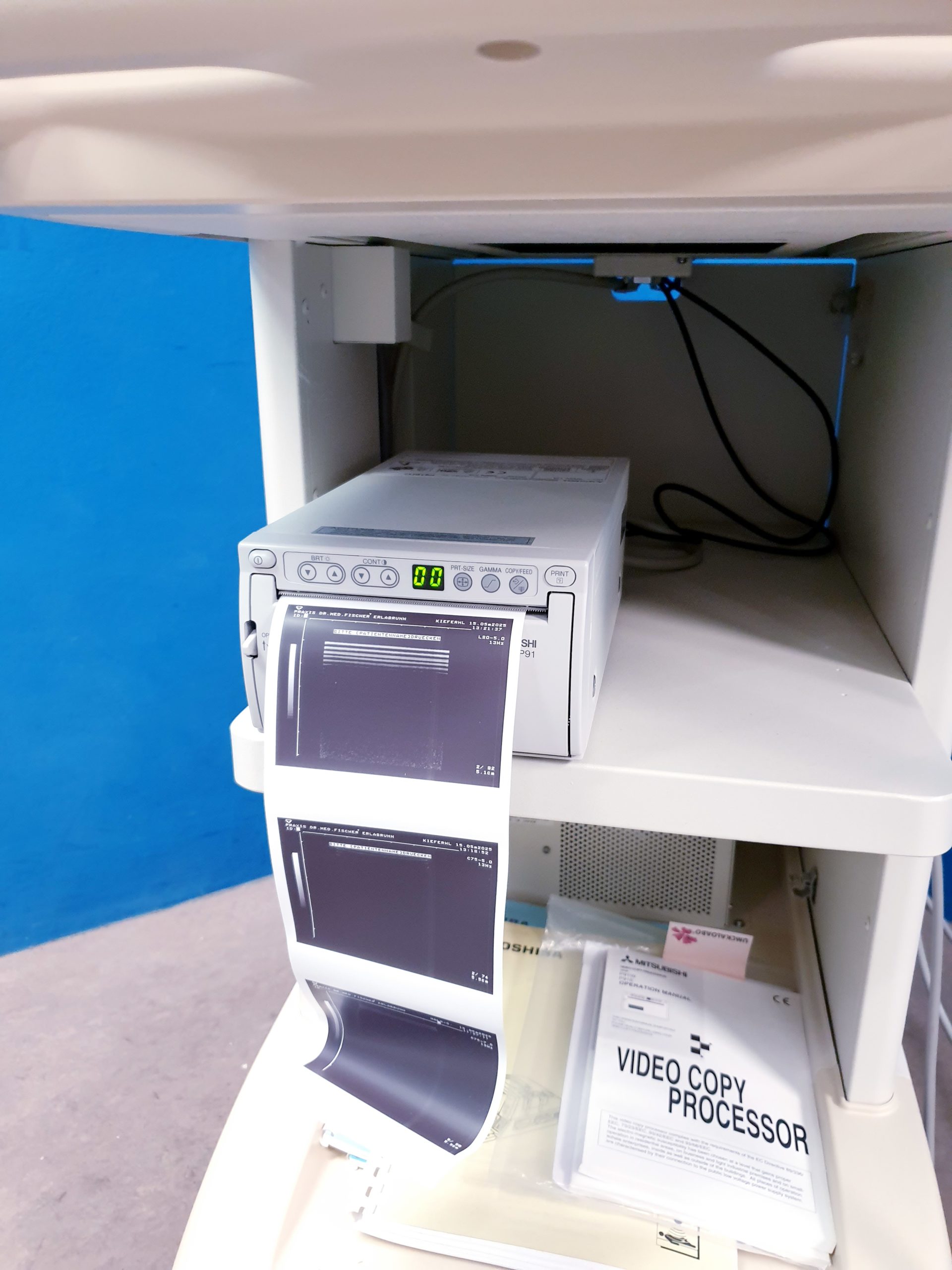 Toshiba Just Vision 400 Justvision 400 SSA-325 + Konvex + Linear – Bild 37