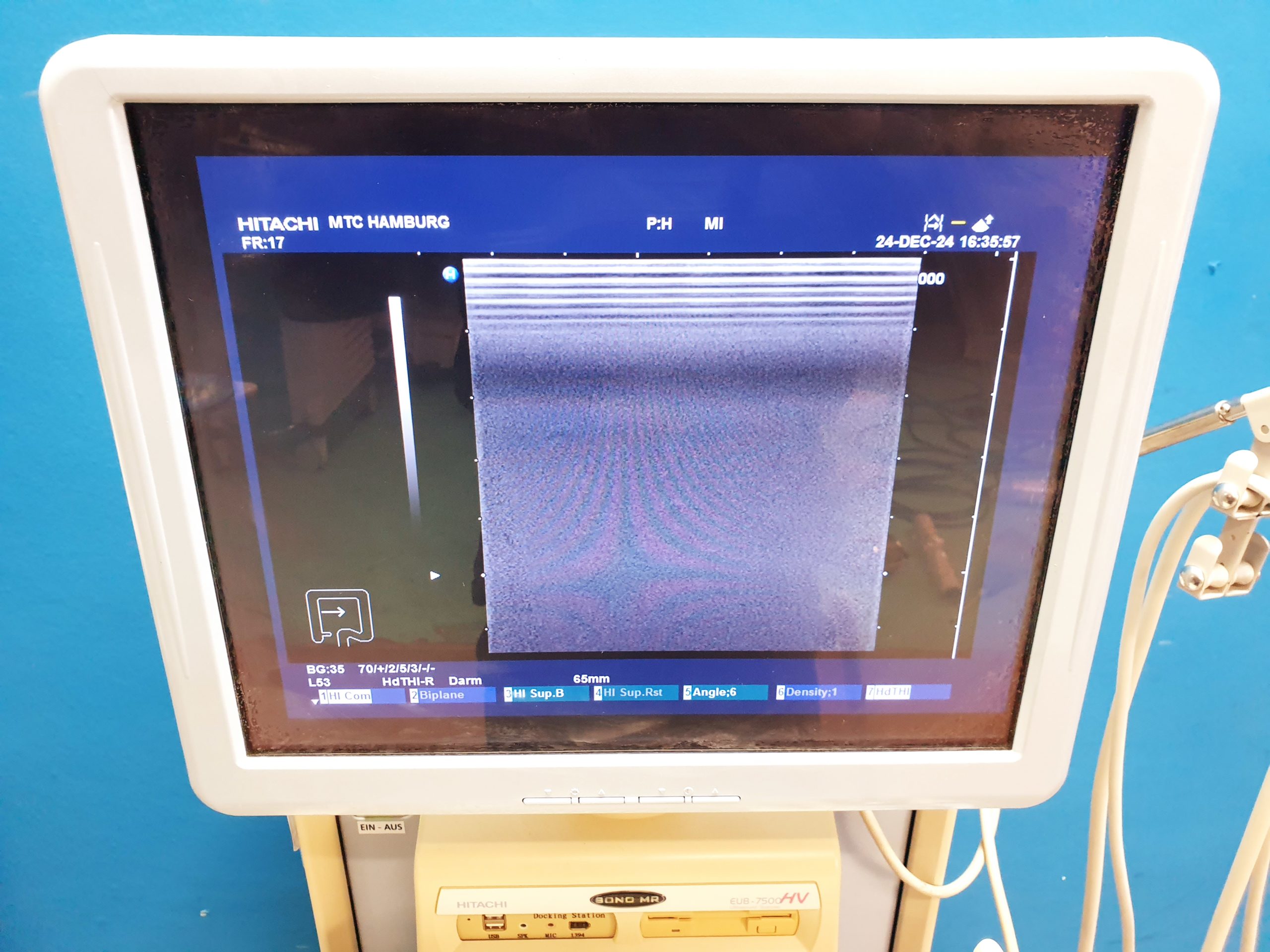 Hitachi EUP-L53 Linear 10.0 - 5.0 MHz Linear