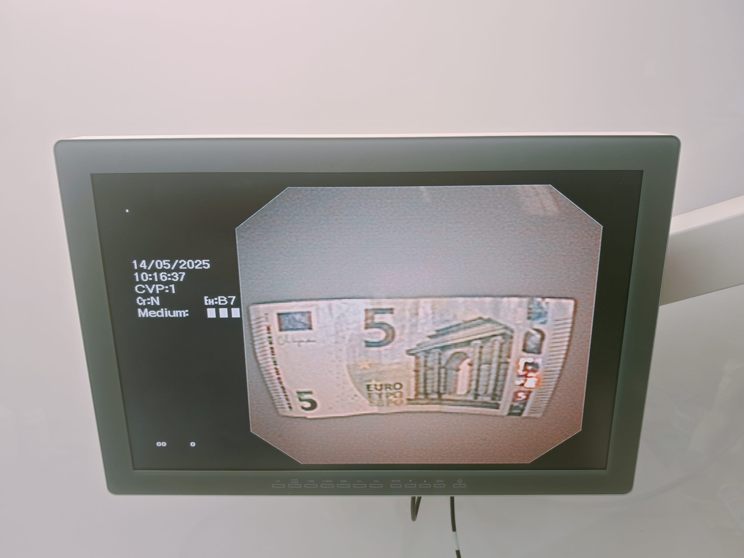 Olympus GIF-2T160 GIF 2T 160 Videogastroskop – Bild 5