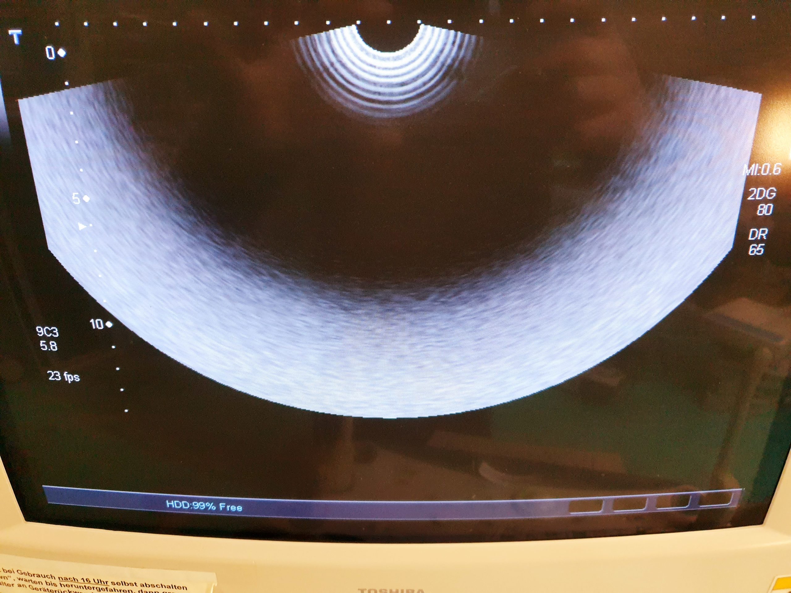 Toshiba PVT-661VT Transducer Ultrasound Probe – Bild 3