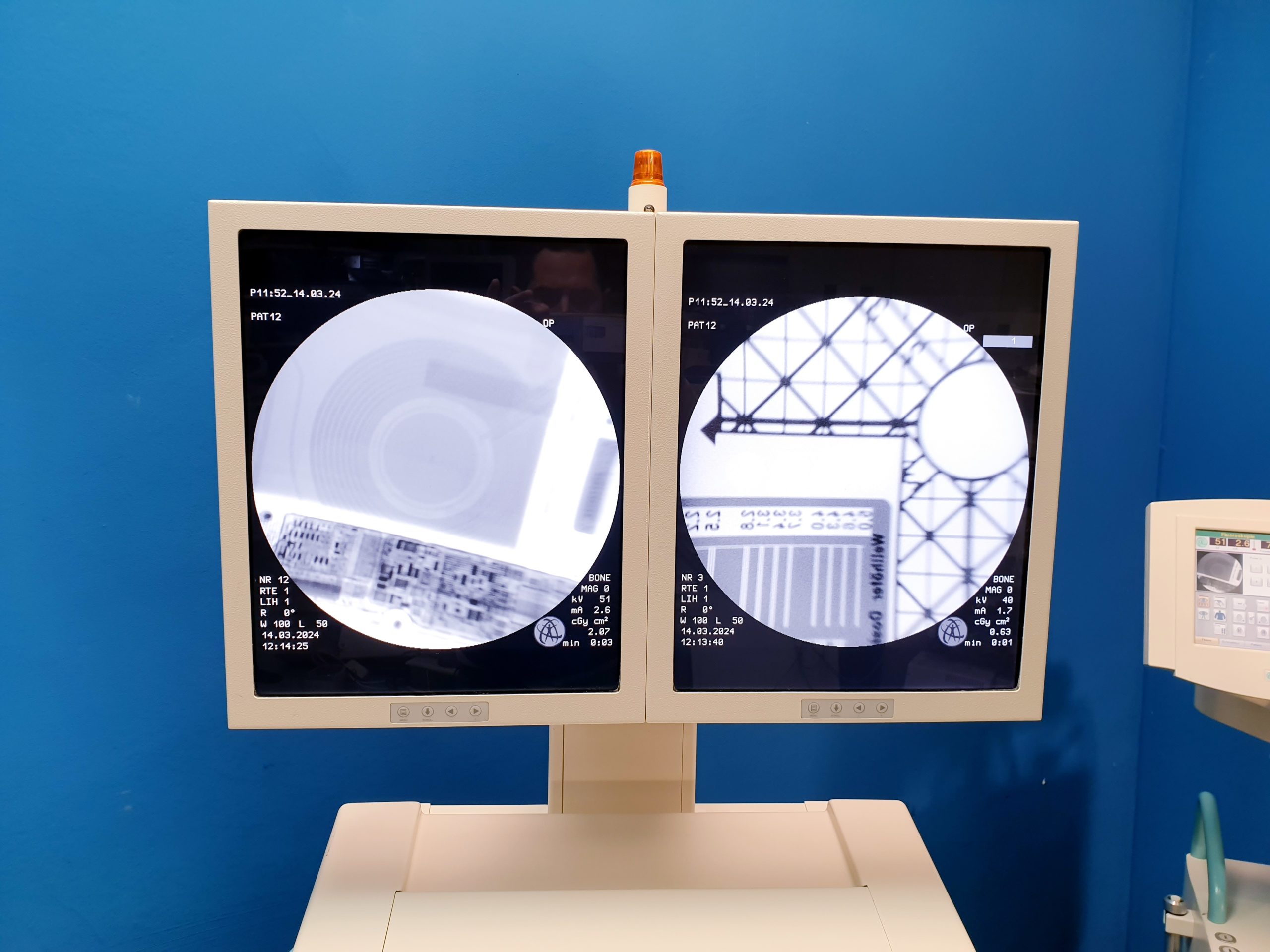 Ziehm Vision 30CM BV DOM 2014 – Bild 9