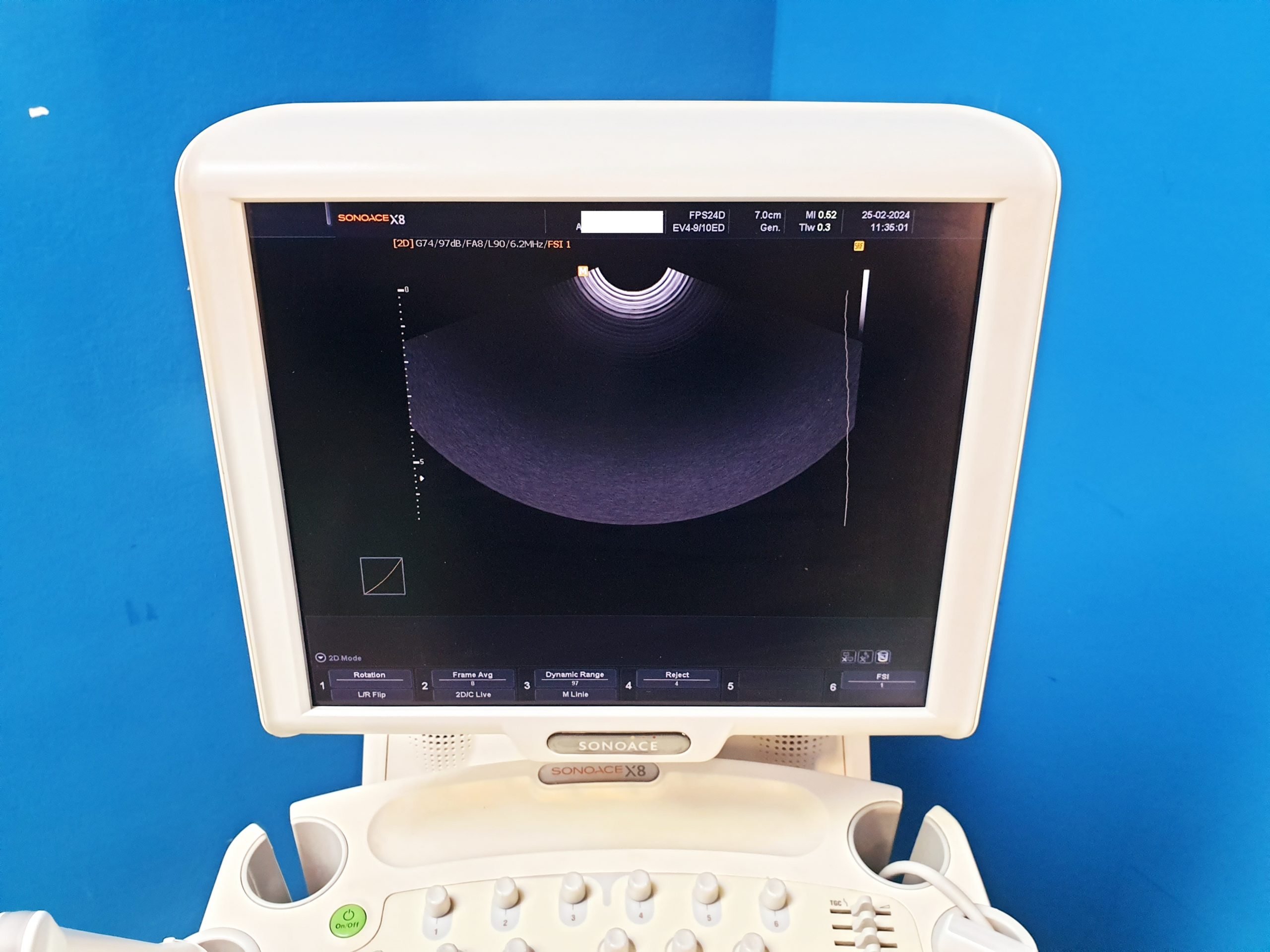 Sonoace Samsung L5-12EC + 3D4-8ET + EV4-910ED 3D 4D Ultraschallgerät – Bild 6