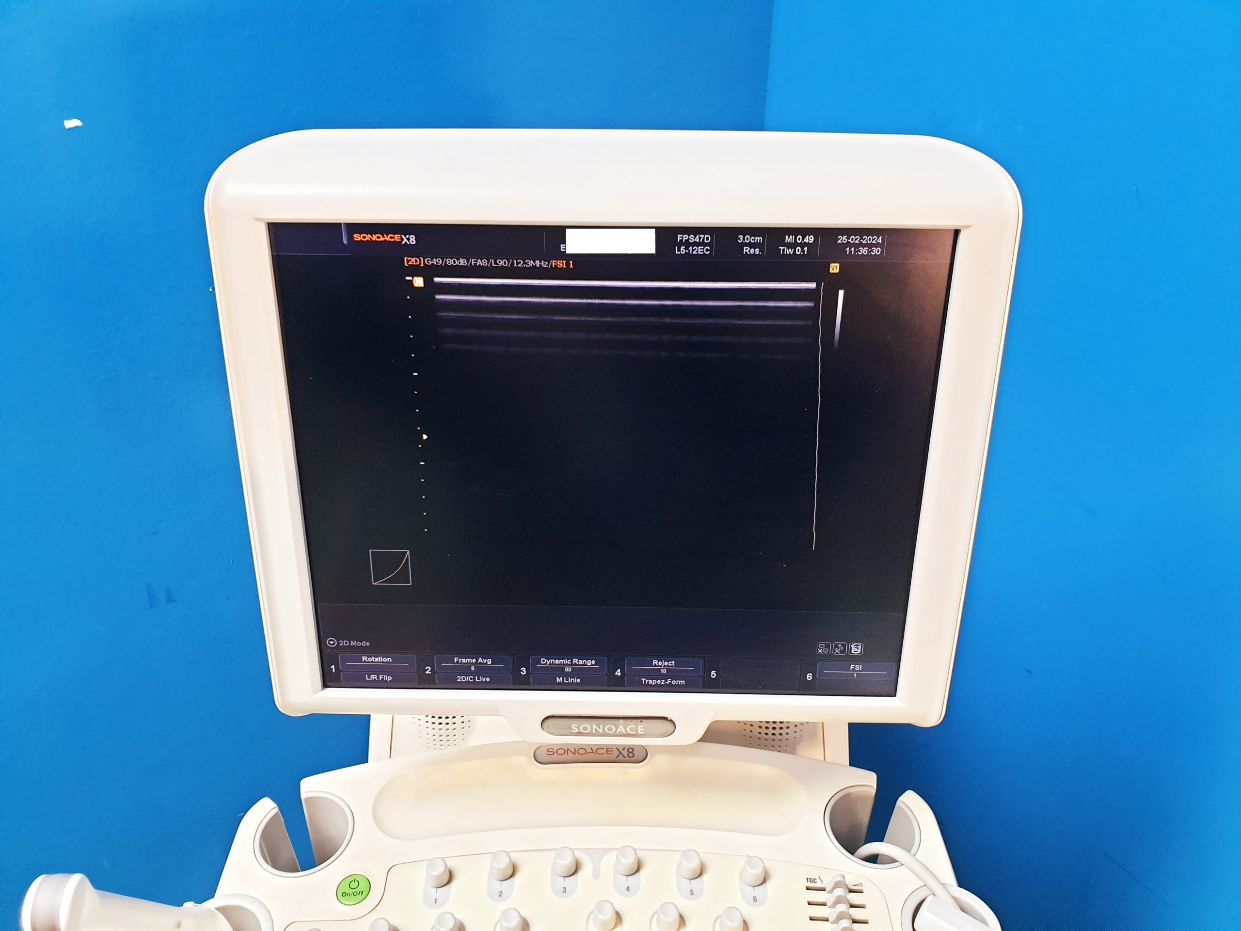 Sonoace Samsung L5-12EC + 3D4-8ET + EV4-910ED 3D 4D Ultraschallgerät – Bild 9