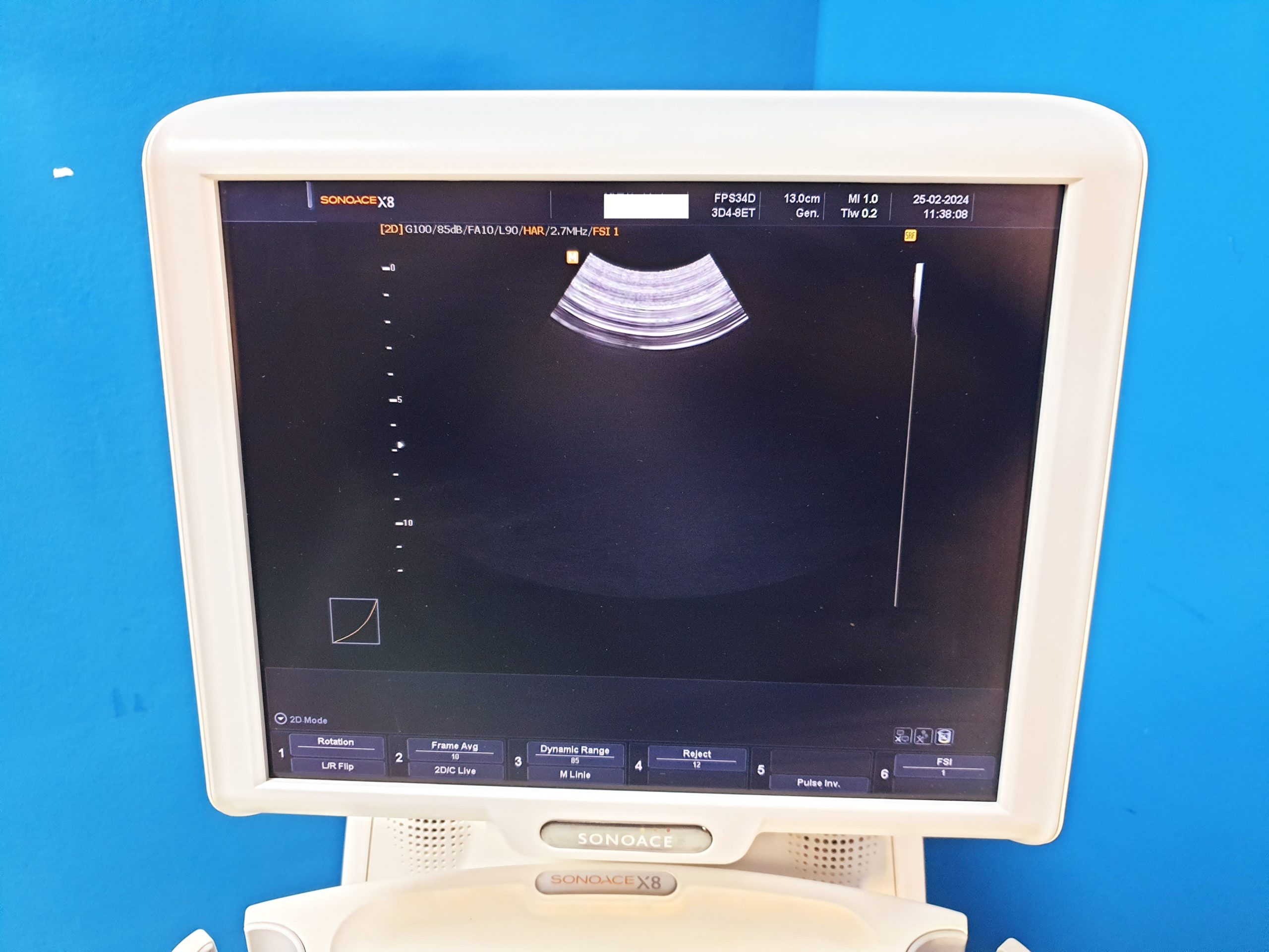 Sonoace Samsung L5-12EC + 3D4-8ET + EV4-910ED 3D 4D Ultraschallgerät – Bild 12