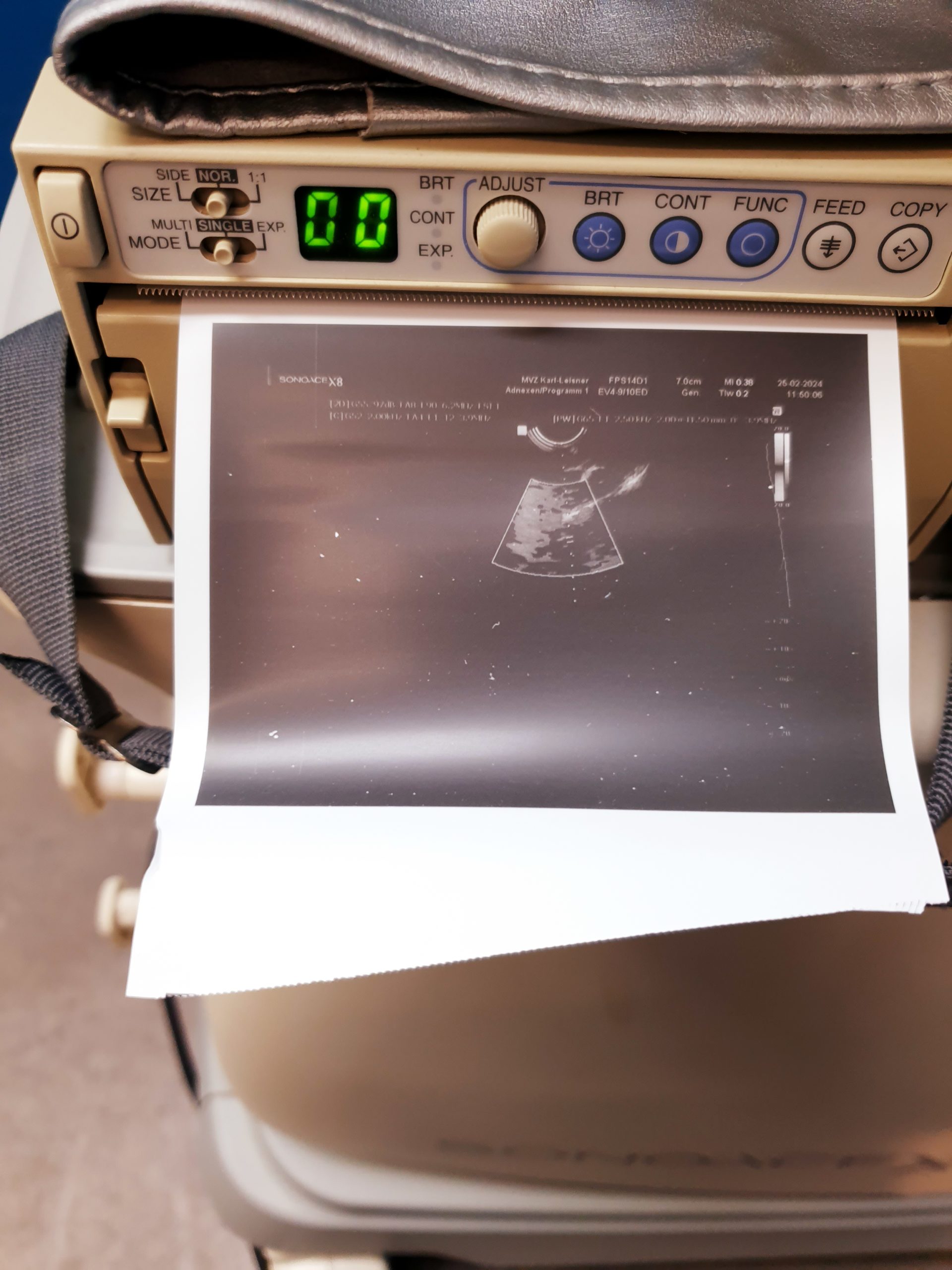 Sonoace Samsung L5-12EC + 3D4-8ET + EV4-910ED 3D 4D Ultraschallgerät – Bild 20