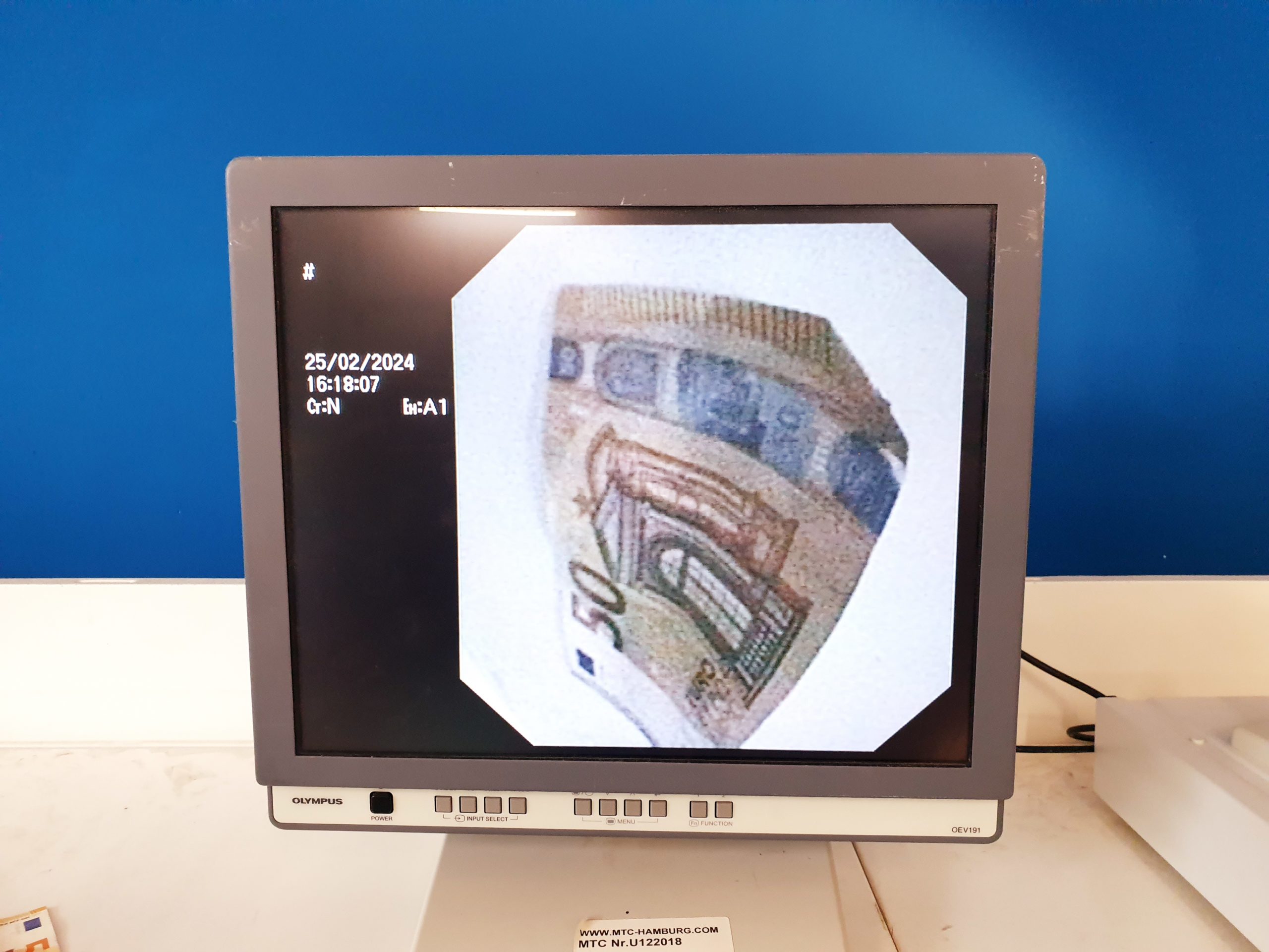 Olympus TJF-160R therapeutisches Duodenoskop – Bild 4