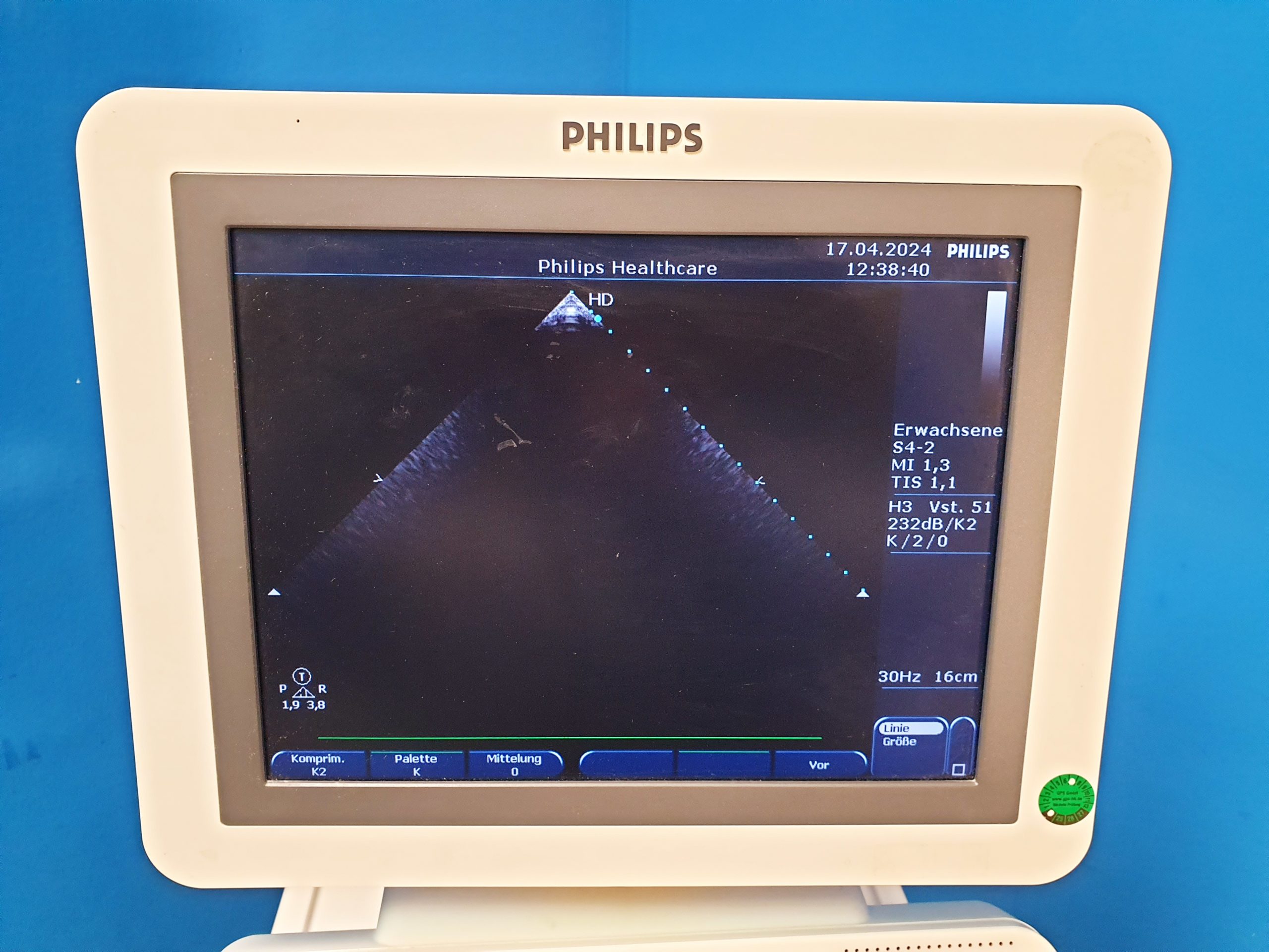 Philips HD7 Ultraschallgerät + S4-2 + L12-3 - Kardiomaschine – Bild 5