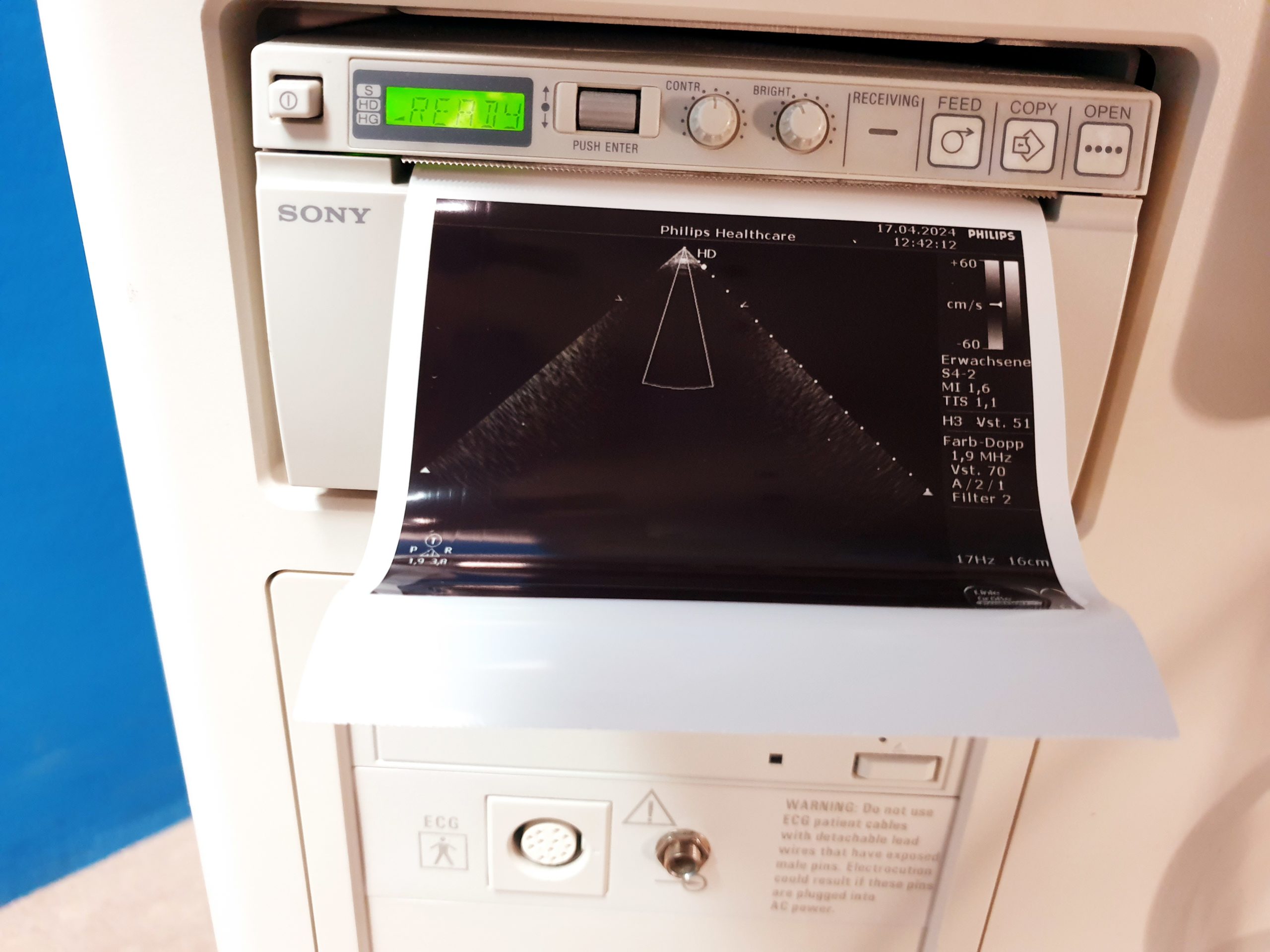 Philips HD7 Ultraschallgerät + S4-2 + L12-3 - Kardiomaschine – Bild 6