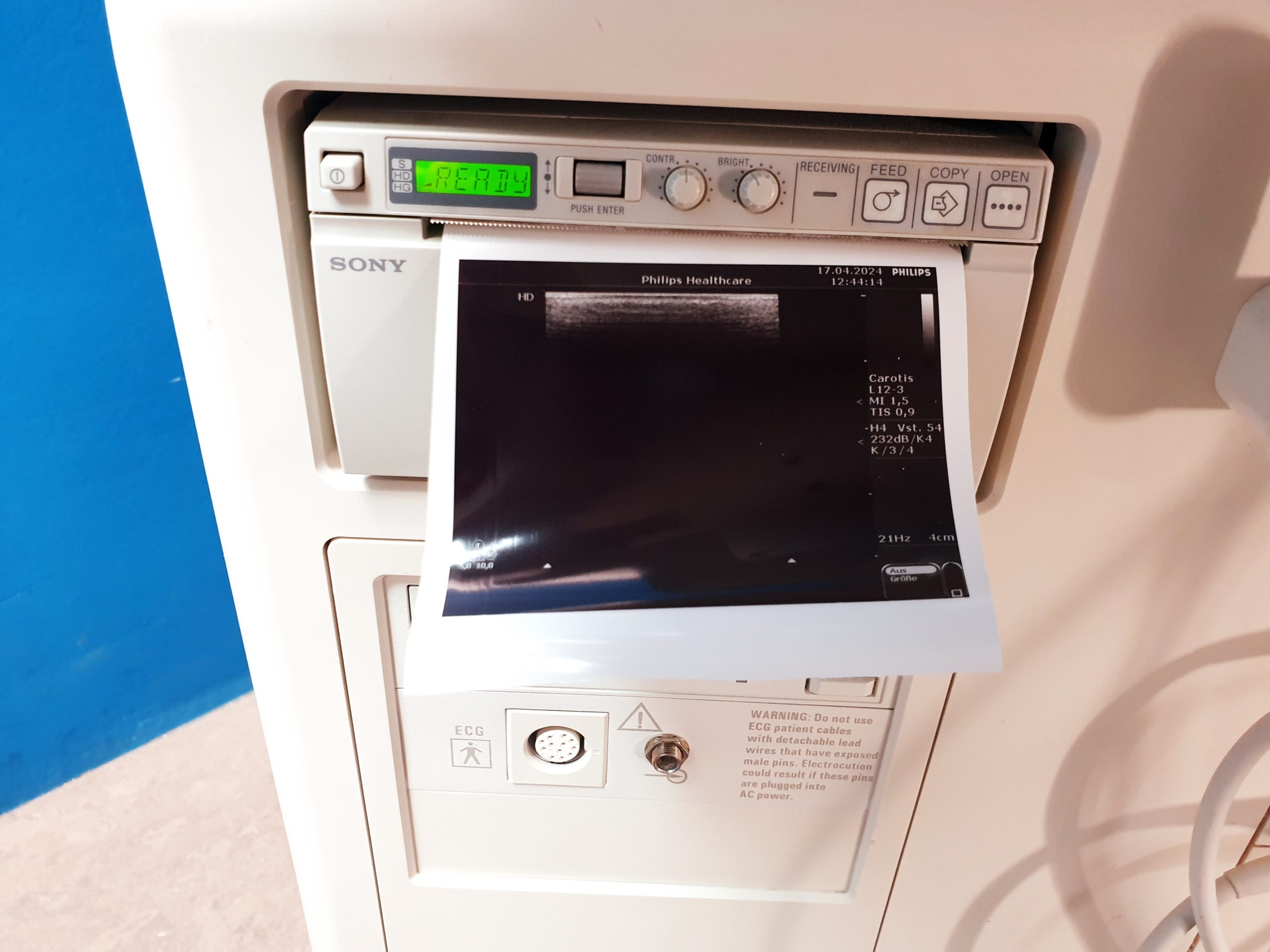 Philips HD7 Ultraschallgerät + S4-2 + L12-3 - Kardiomaschine – Bild 10