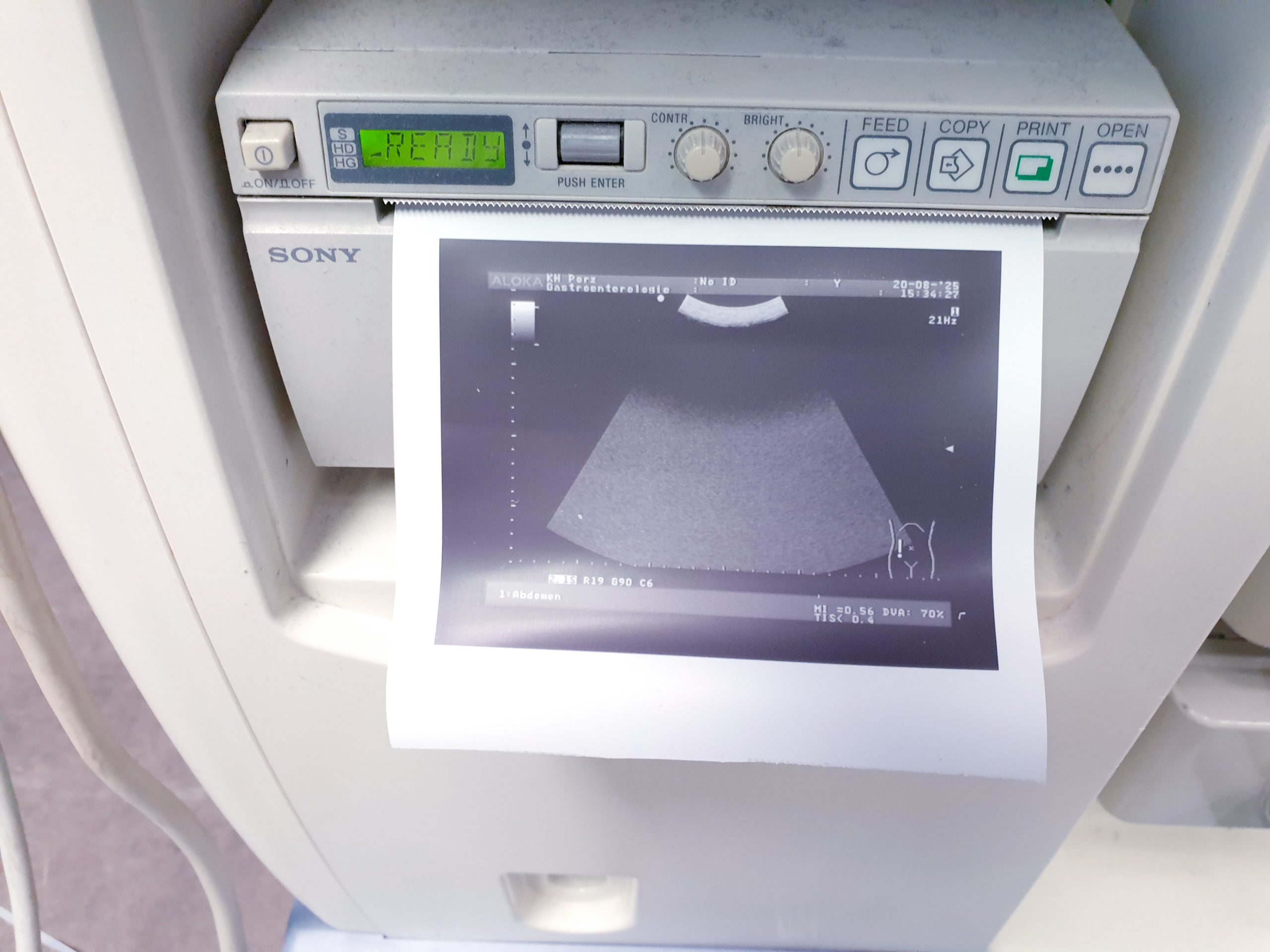 ALOKA UST-9126 Konvex Sonde – Bild 19