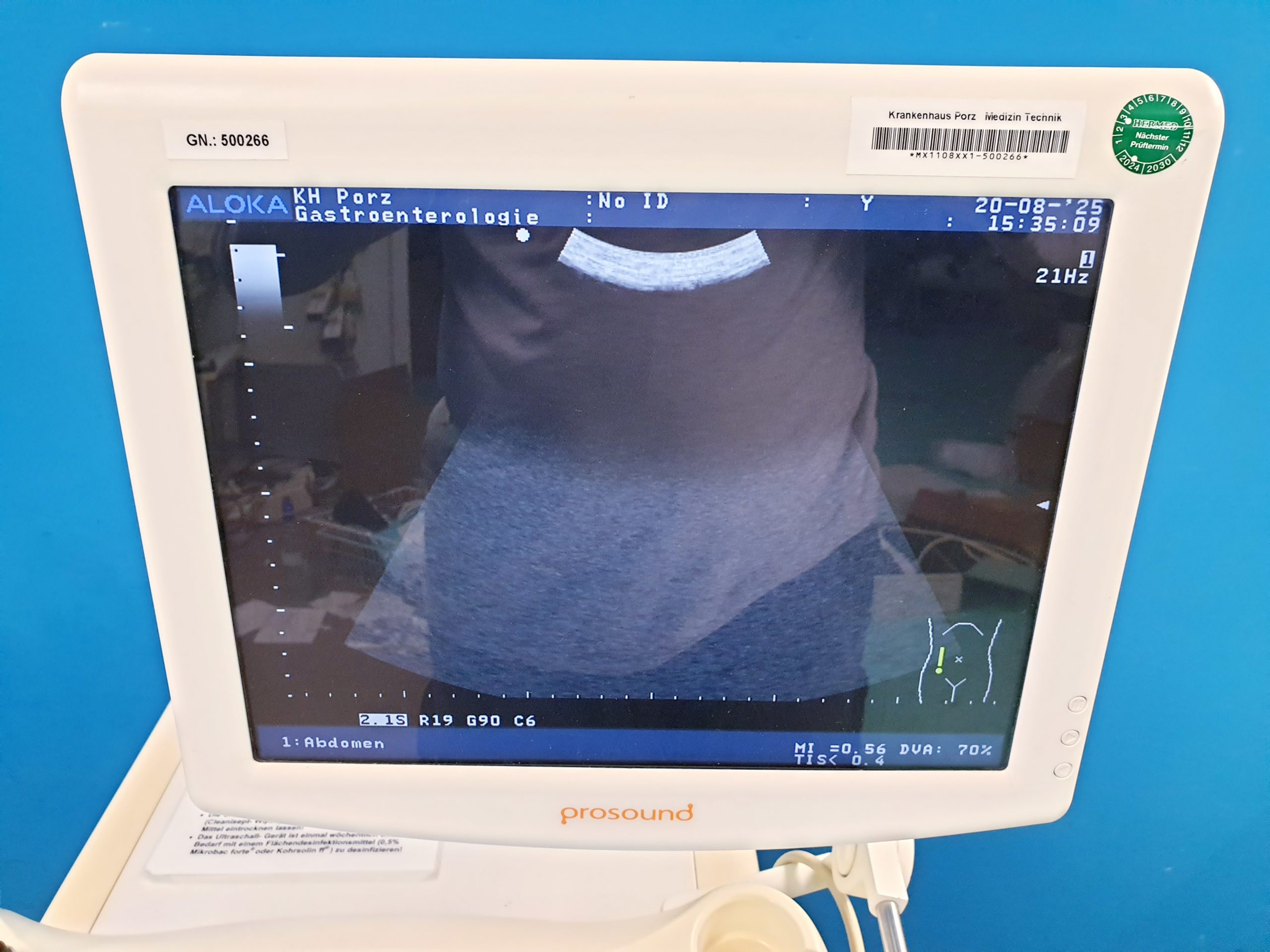 ALOKA UST-9126 Konvex Sonde – Bild 20