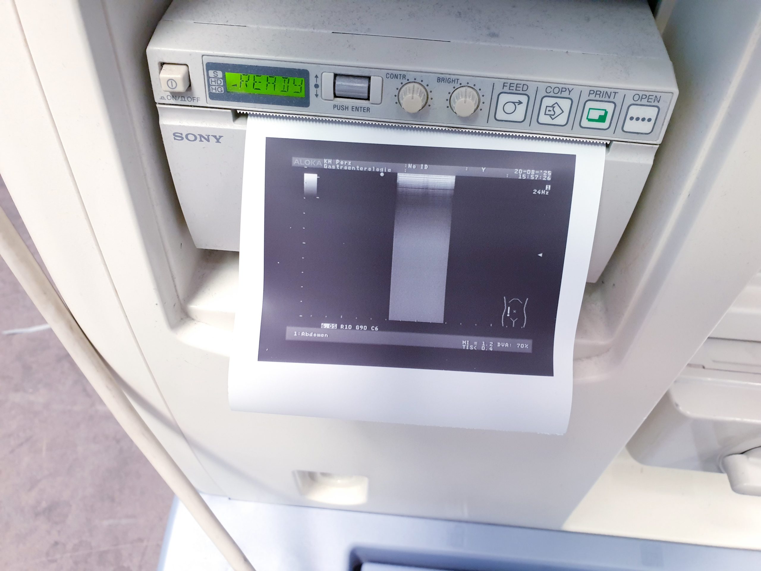 Aloka UST-5410H - UST 5410 H Linear Sonde – Bild 20