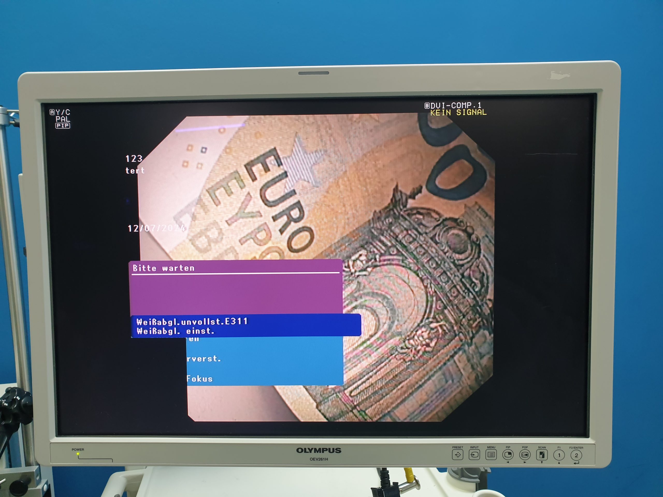 Olympus GF-UCT180 Longitudinales Ultraschallgastroskop – Bild 18