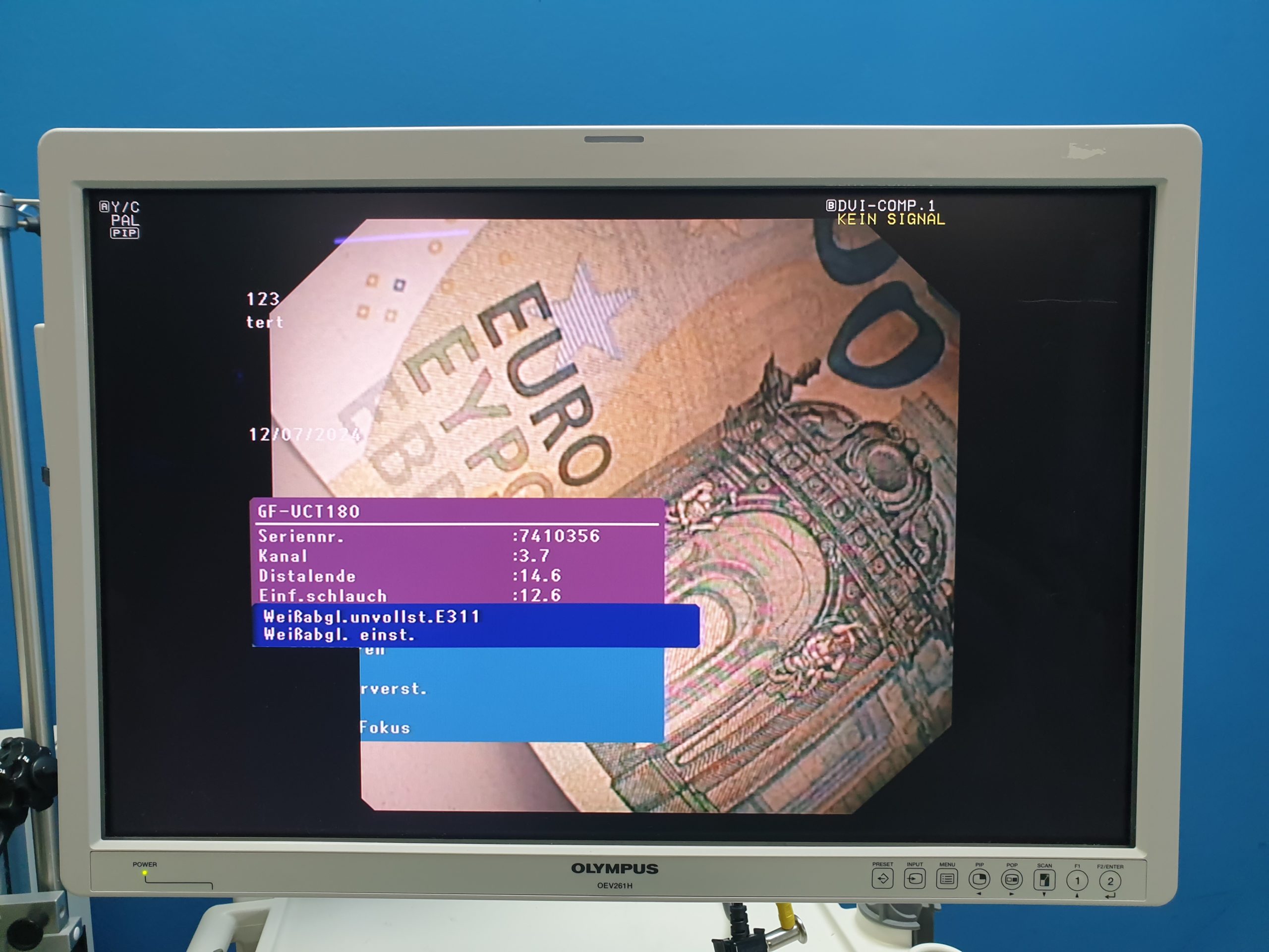 Olympus GF-UCT180 Longitudinales Ultraschallgastroskop – Bild 19