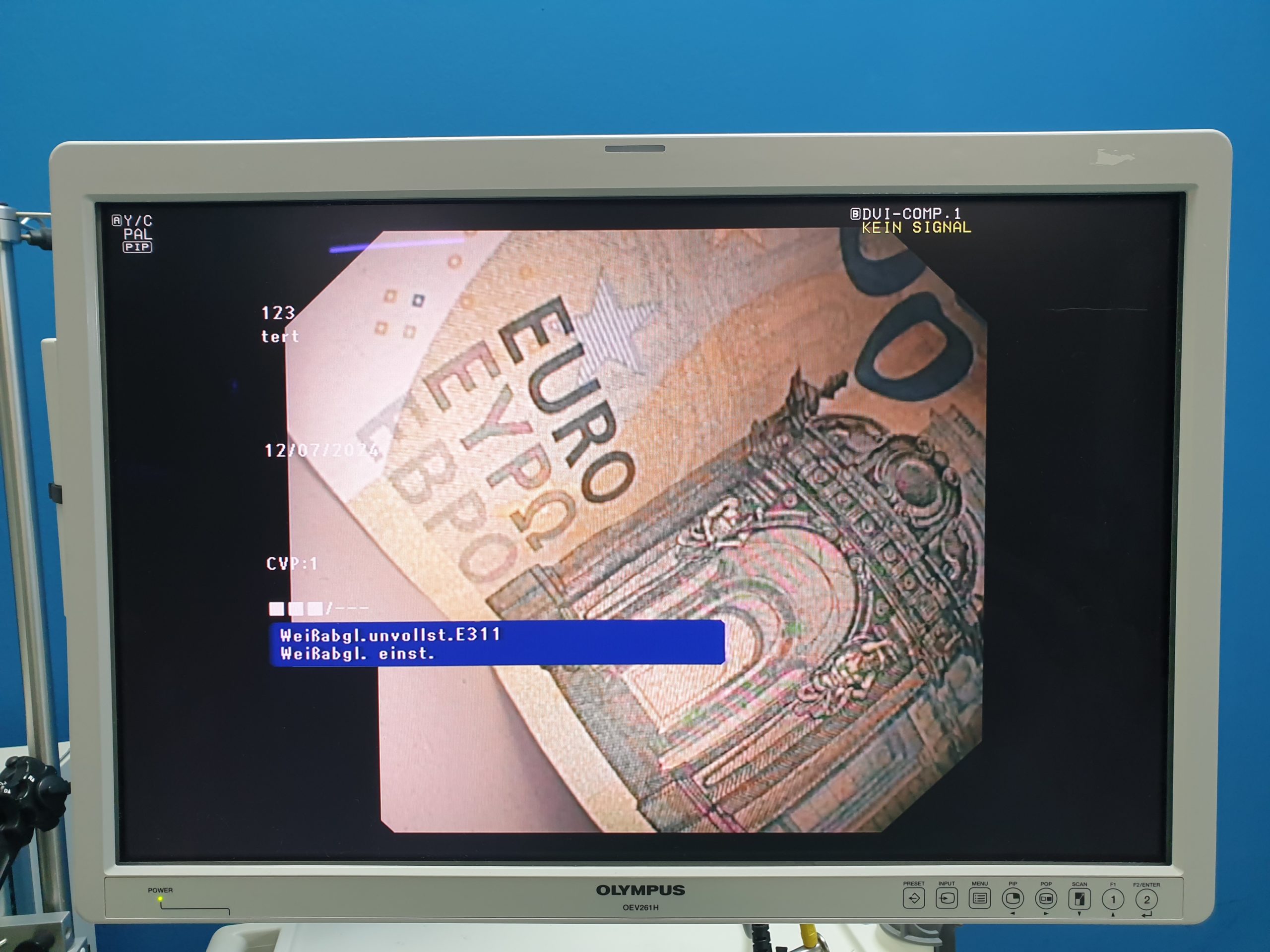 Olympus GF-UCT180 Longitudinales Ultraschallgastroskop – Bild 20