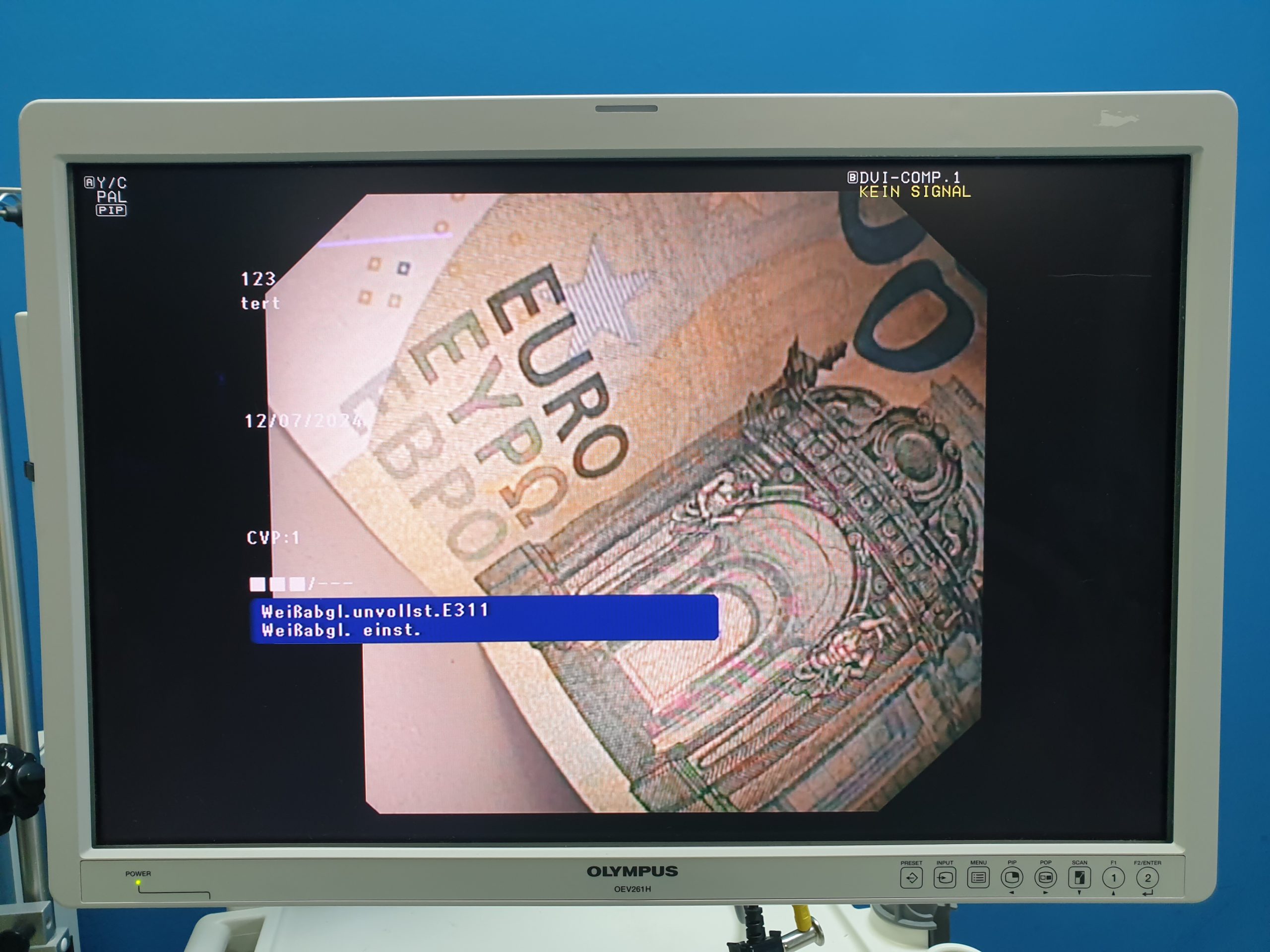 Olympus GF-UCT180 Longitudinales Ultraschallgastroskop – Bild 21