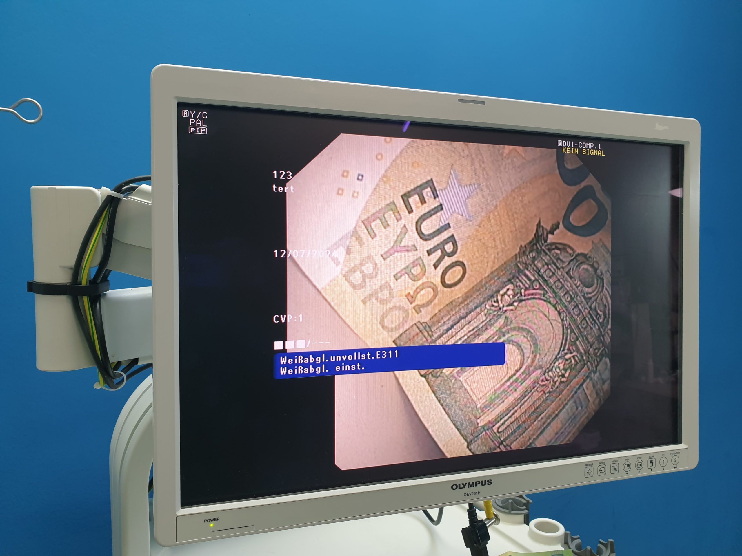 Olympus GF-UCT180 Longitudinales Ultraschallgastroskop – Bild 22