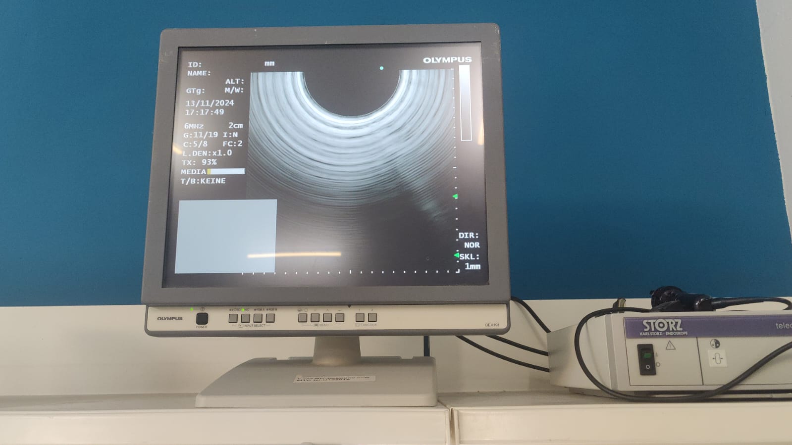 Olympus GF-UCT180 Longitudinales Ultraschallgastroskop – Bild 25