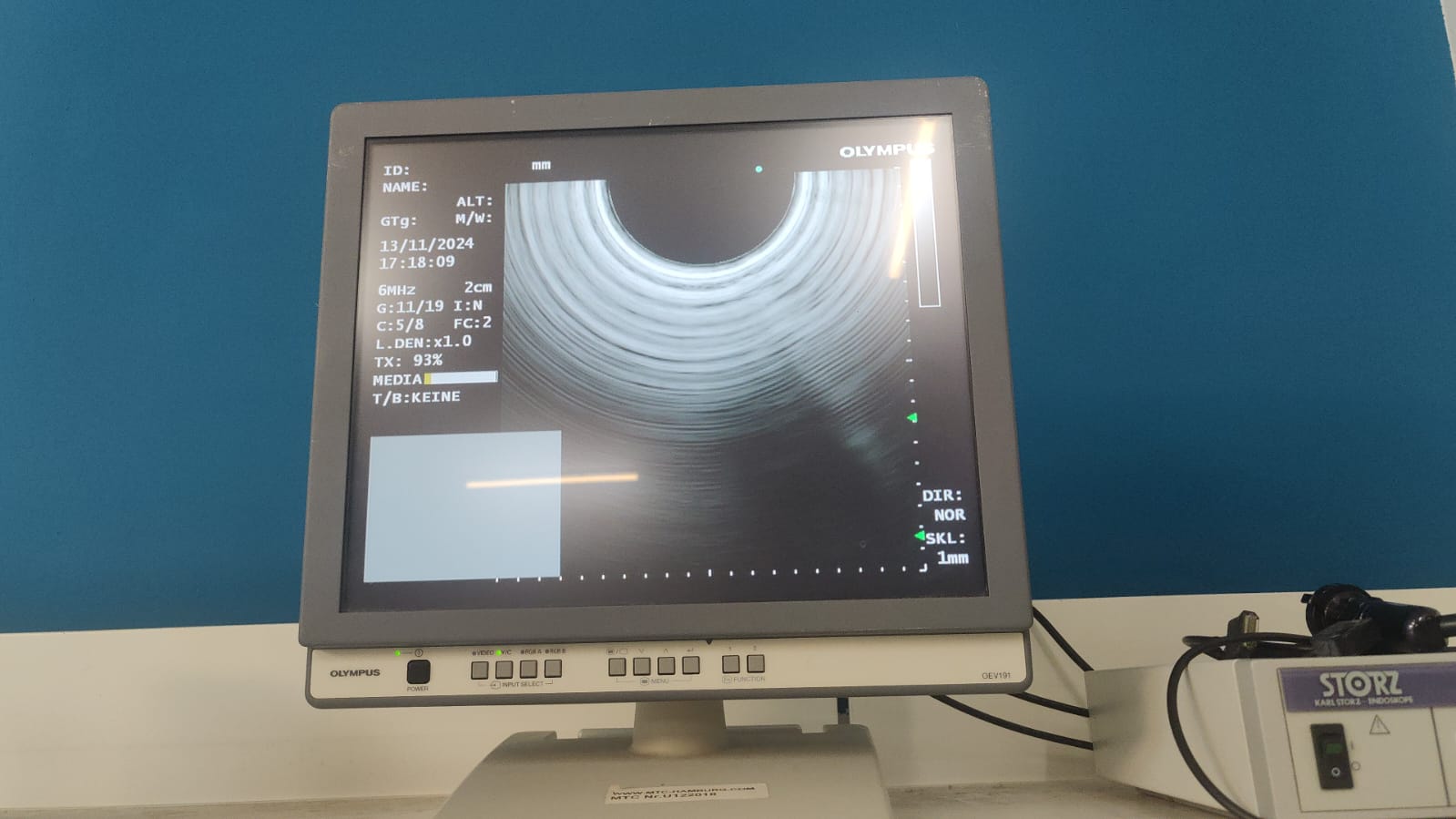 Olympus GF-UCT180 Longitudinales Ultraschallgastroskop – Bild 23