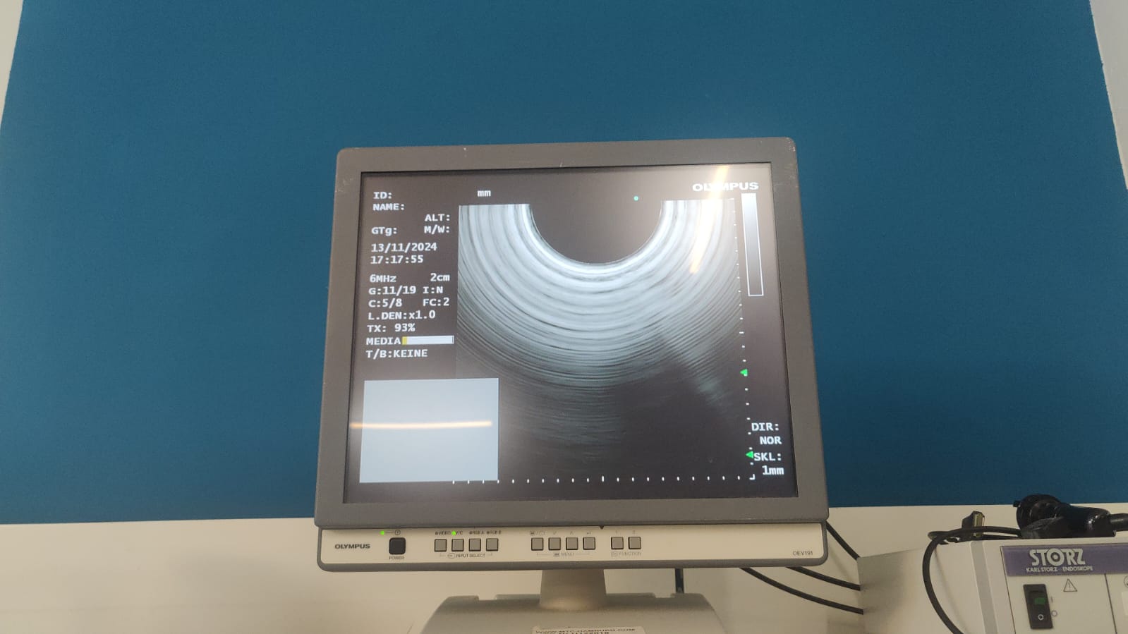 Olympus GF-UCT180 Longitudinales Ultraschallgastroskop – Bild 24