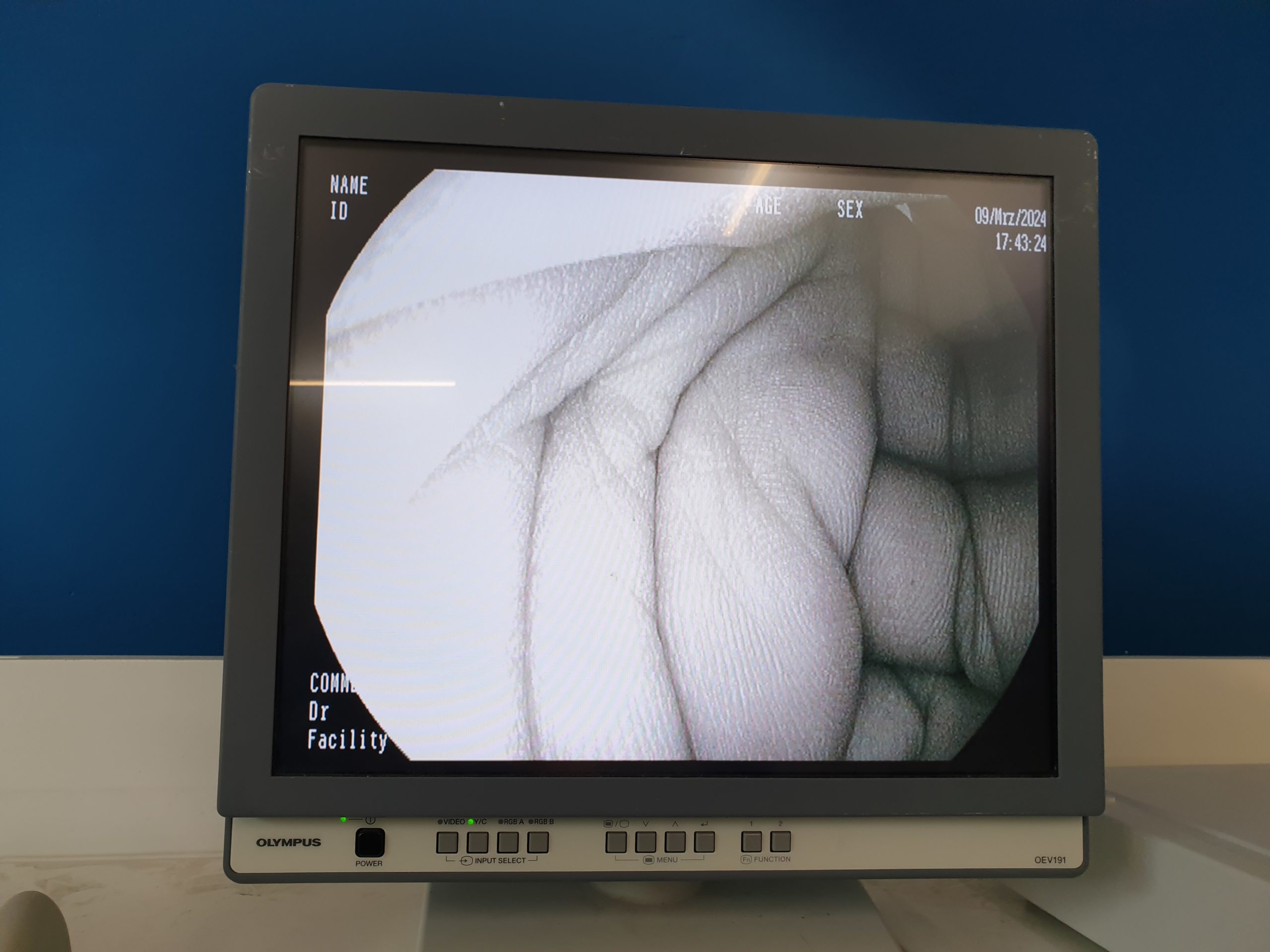 Pentax EG-2990I EG 2990 i Videogastroskop Gastroskop geprüft – Bild 13