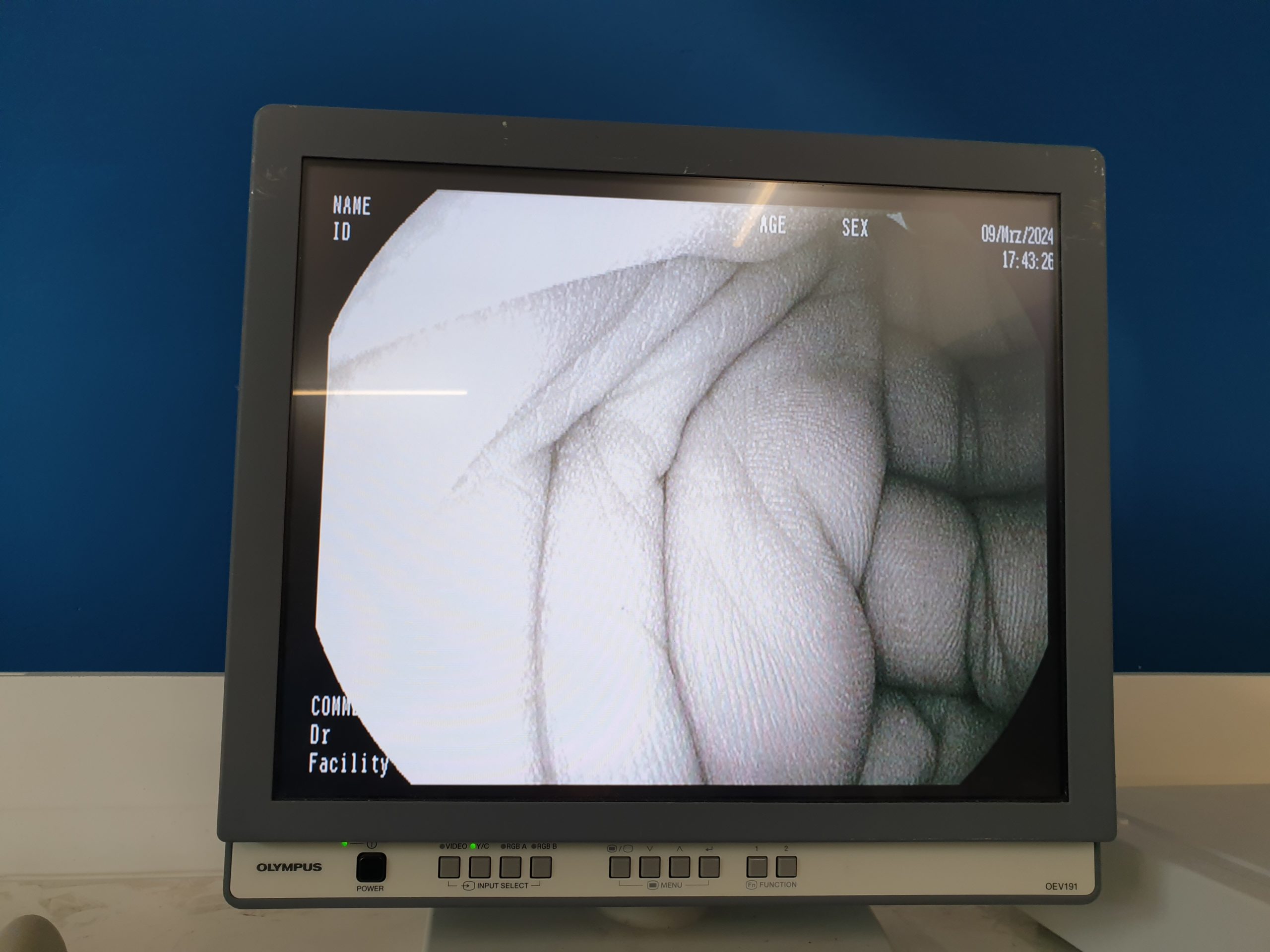 Pentax EG-2990I EG 2990 i Videogastroskop Gastroskop geprüft – Bild 14