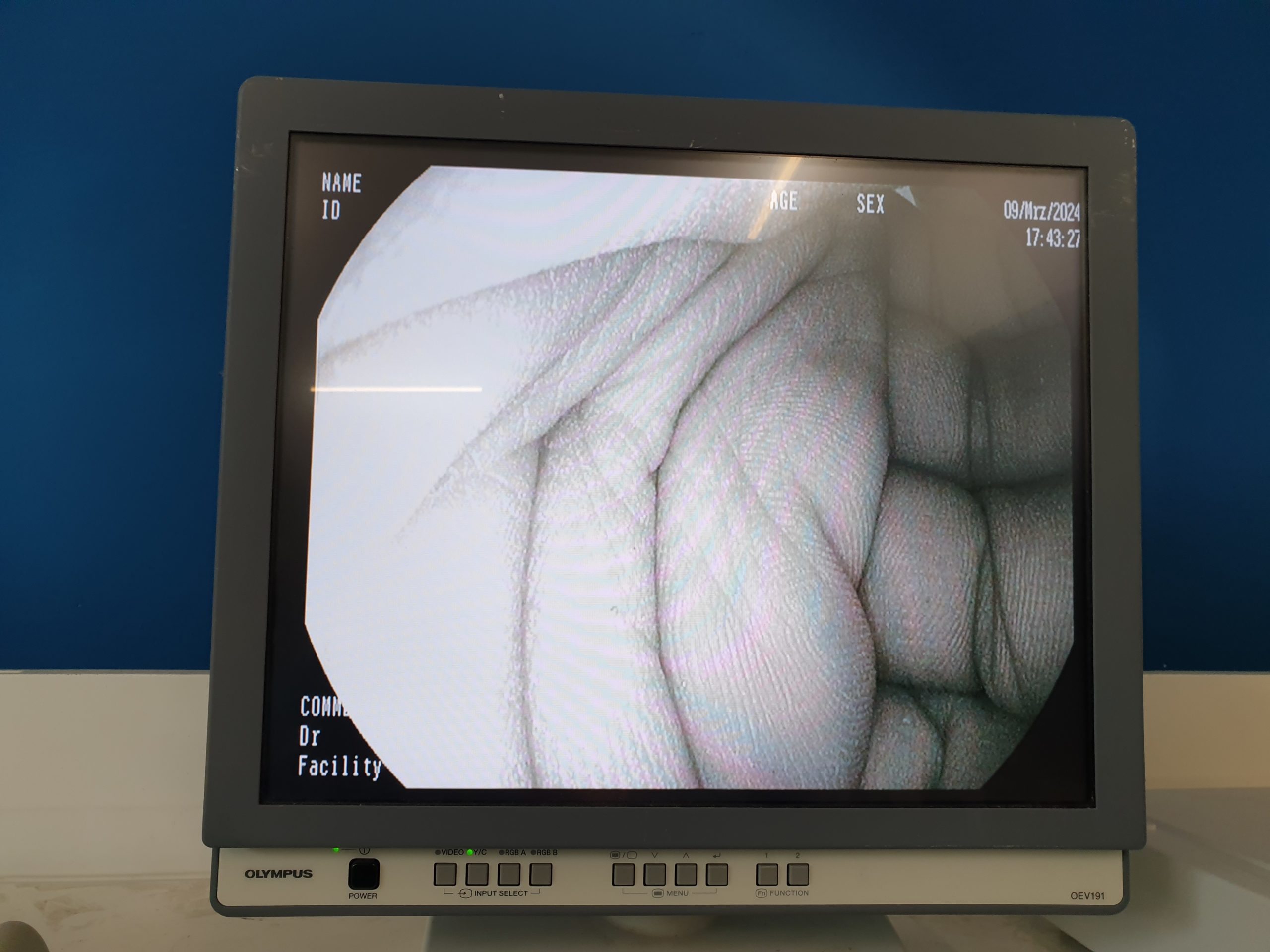 Pentax EG-2990I EG 2990 i Videogastroskop Gastroskop geprüft – Bild 15