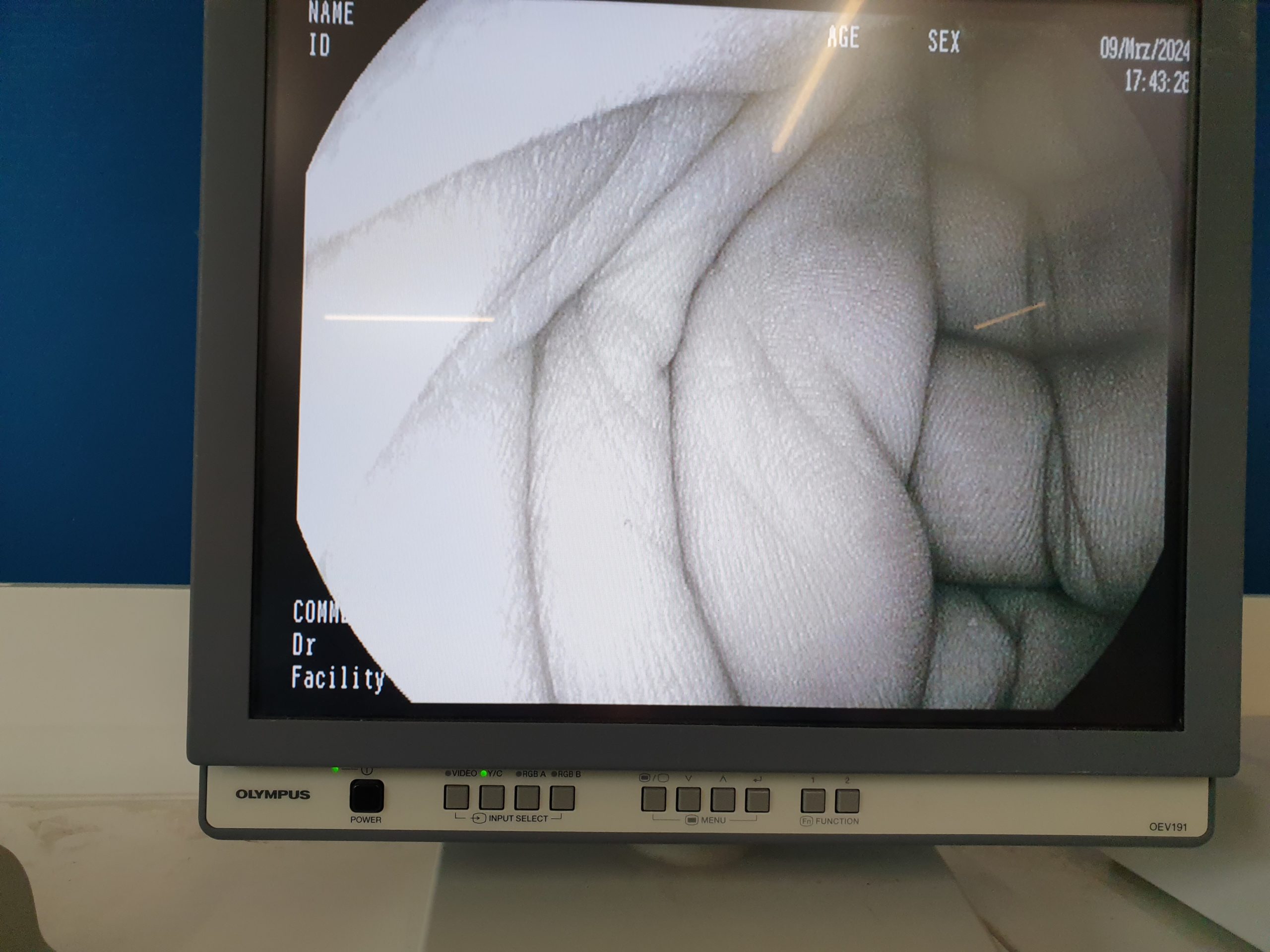 Pentax EG-2990I EG 2990 i Videogastroskop Gastroskop geprüft – Bild 16