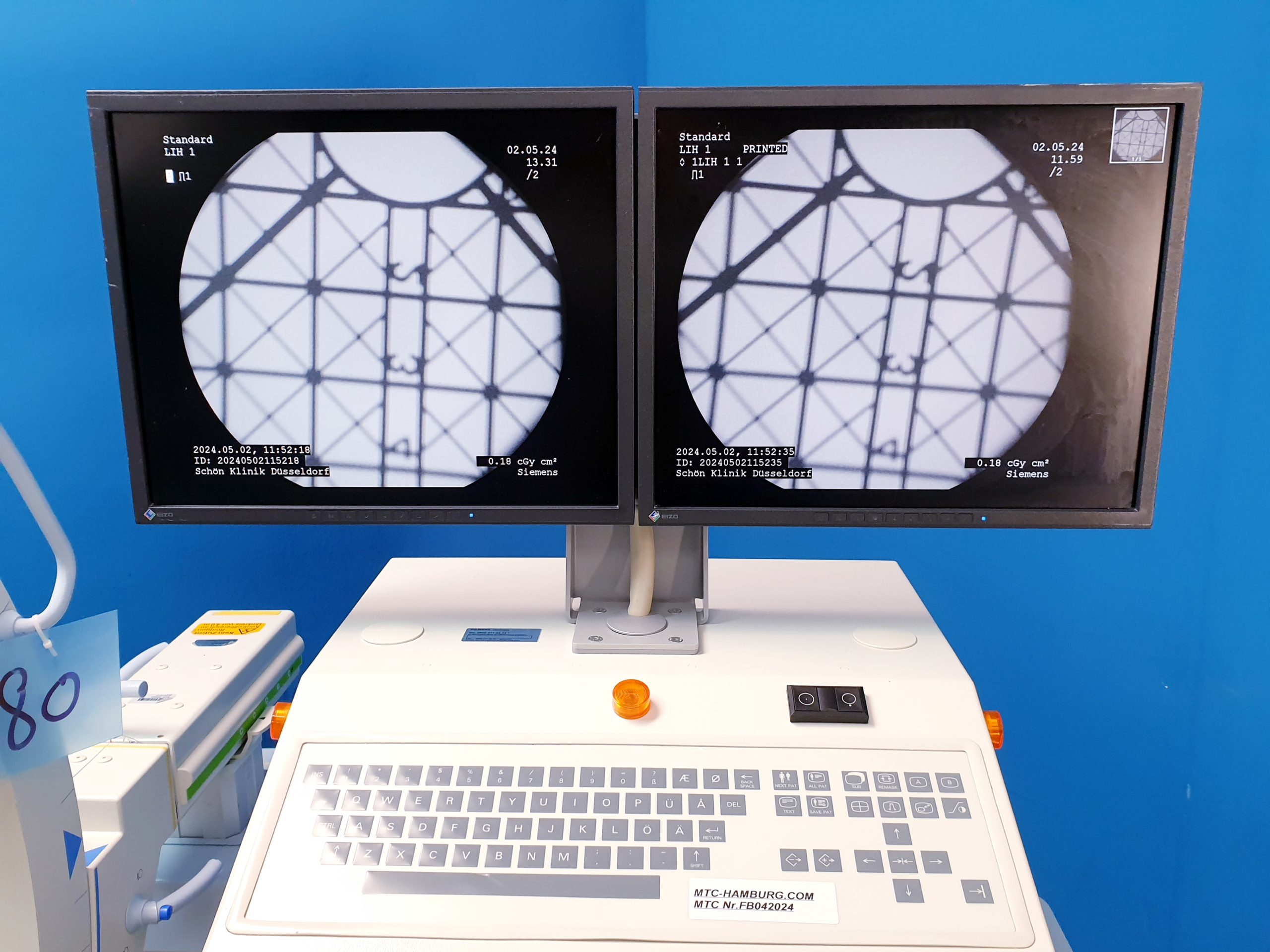 Siemens Siremobil Compact L - Mobiles Röntgengerät – Bild 9