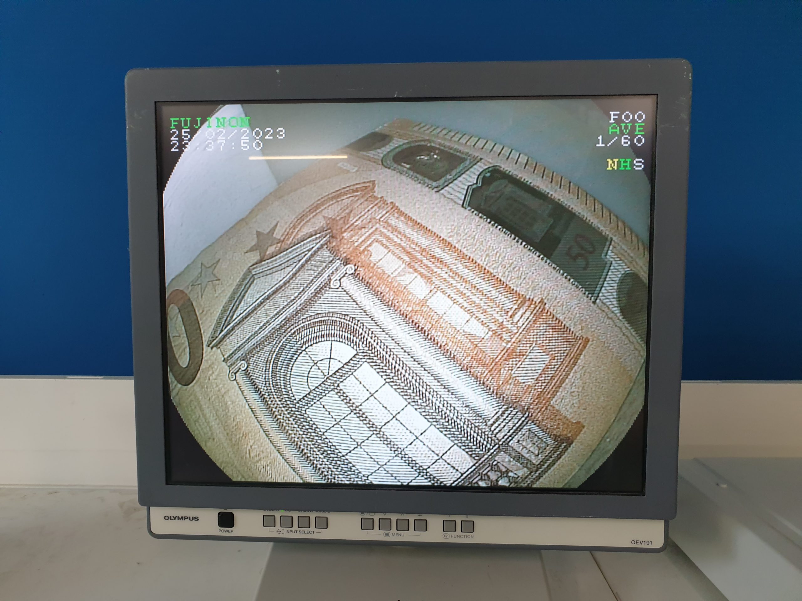 FUJI EG-590WR Gastroskop Videogastroskop – Bild 15