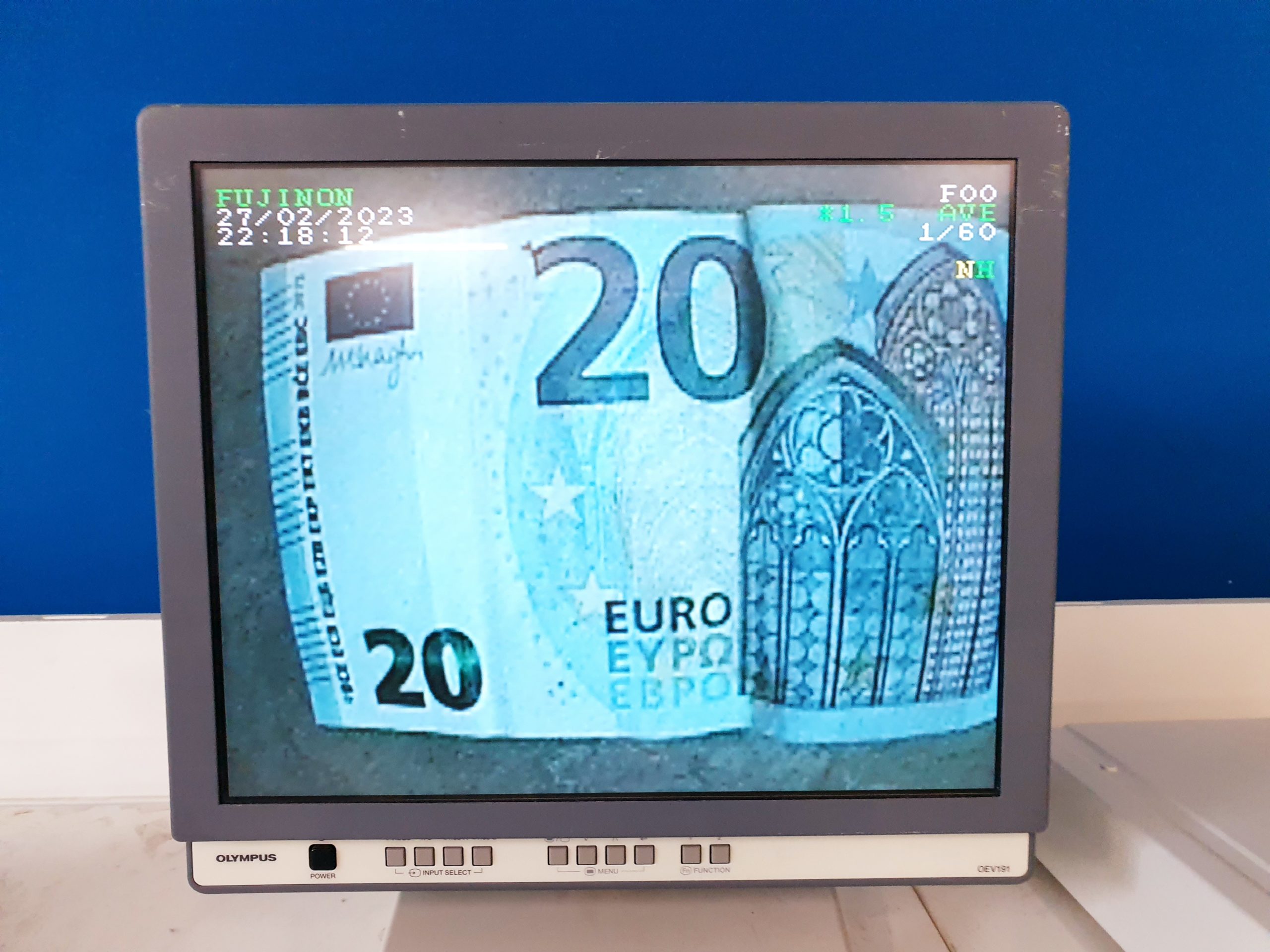 Fujinon Fuji EG-530CT Gastroskop – Bild 13