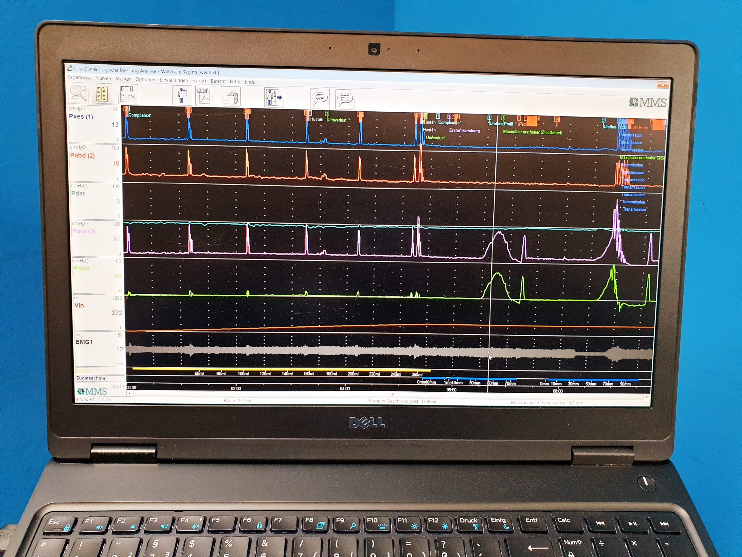 Solar Blue Module + MMS Investigation und Diagnostik Software Urodynamik System – Bild 8