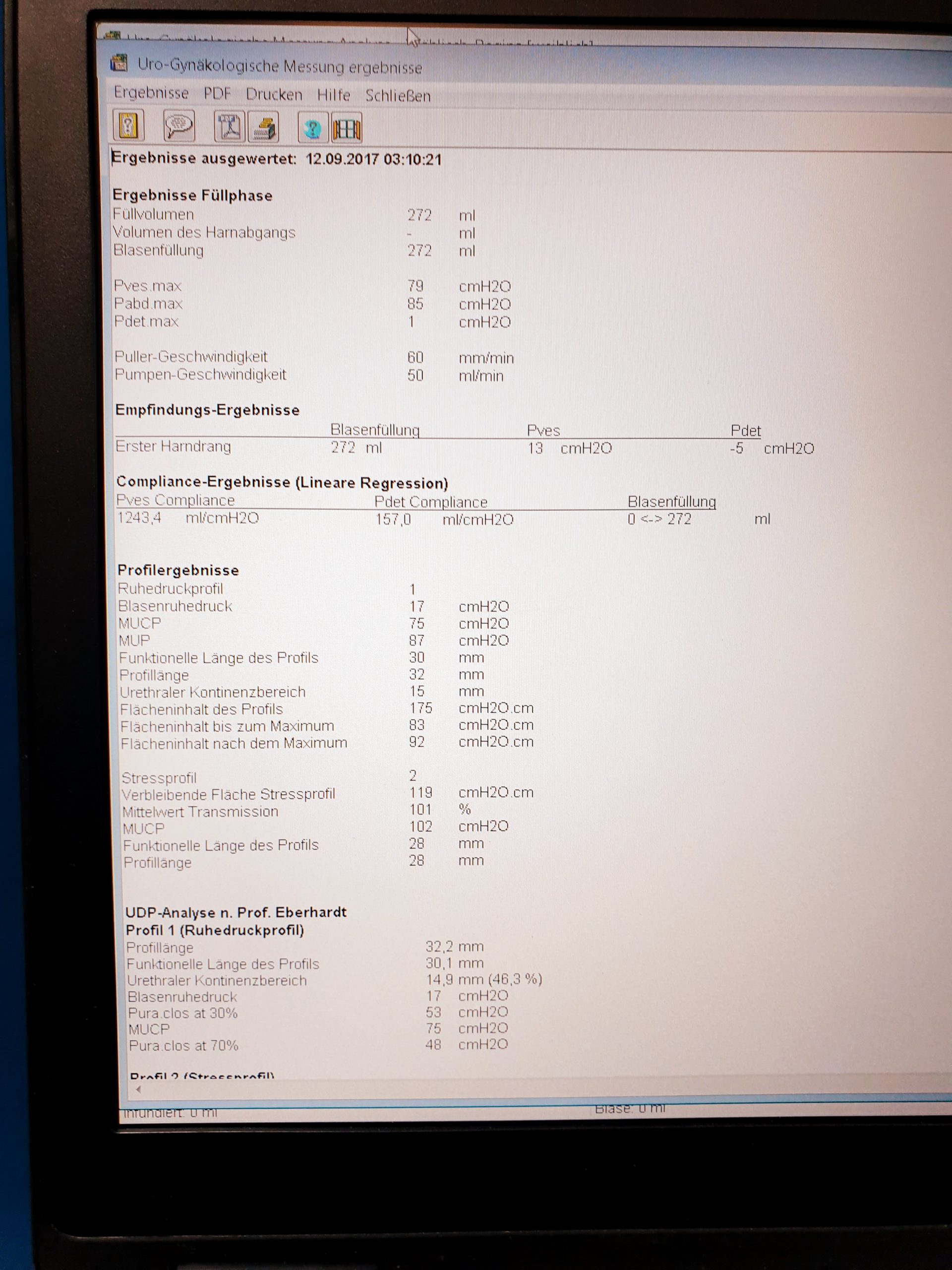 Solar Blue Module + MMS Investigation und Diagnostik Software Urodynamik System – Bild 9