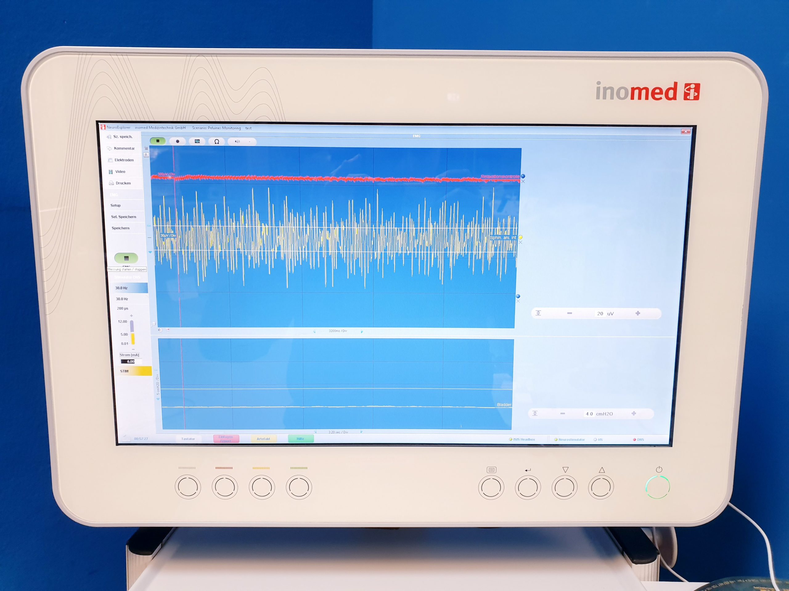 Inomed ISIS IOM Evozierte-Potentiale-Einheit – Bild 12