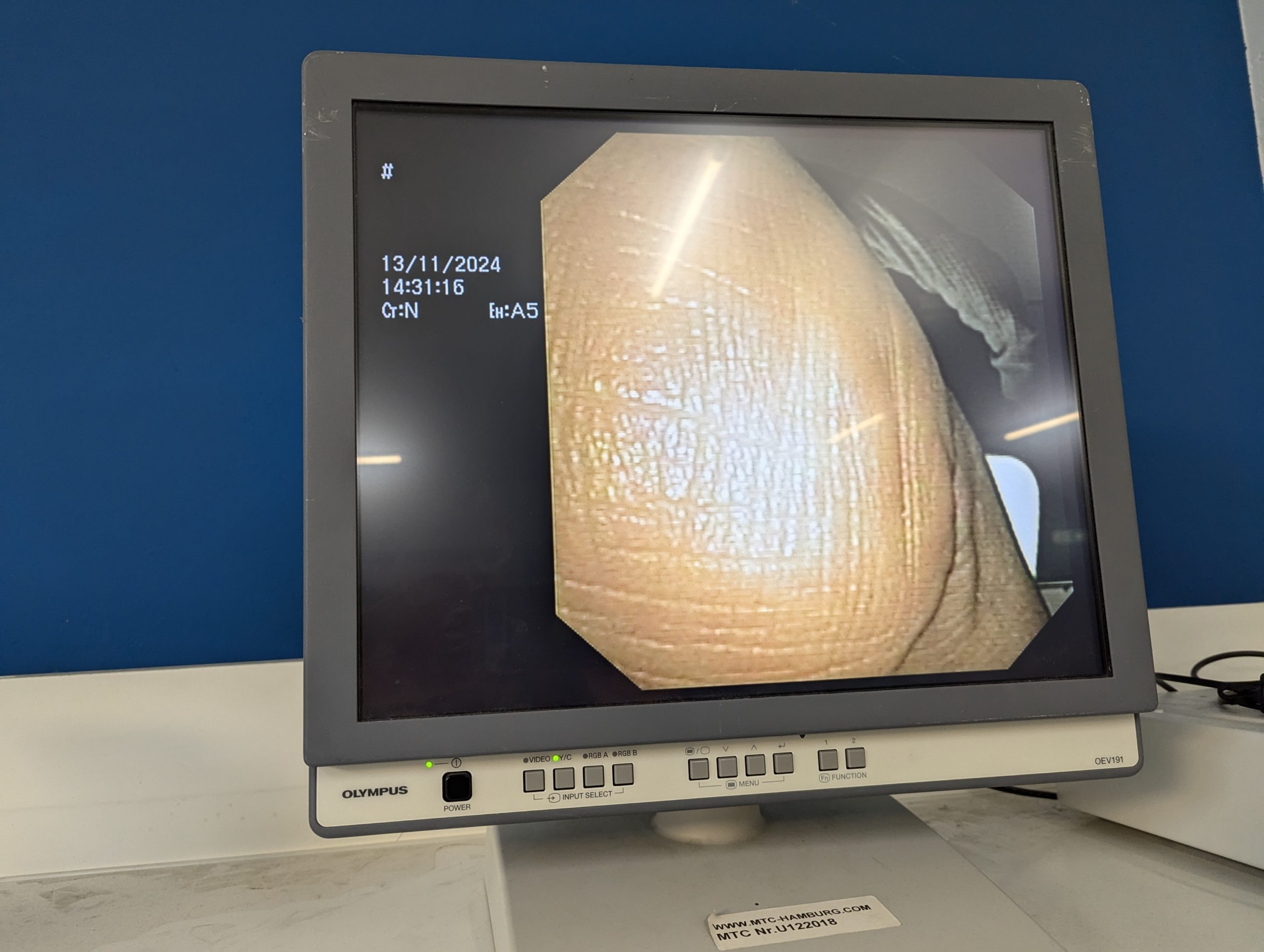 Olympus GF-UE160-AL5 Gastroskop Ultraschall Gastroskope - GEPRÜFT – Bild 18