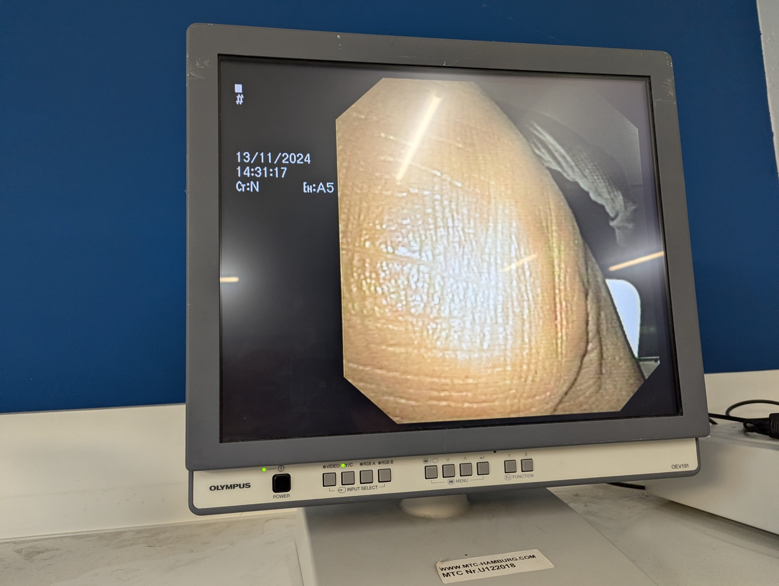 Olympus GF-UE160-AL5 Gastroskop Ultraschall Gastroskope - GEPRÜFT – Bild 19