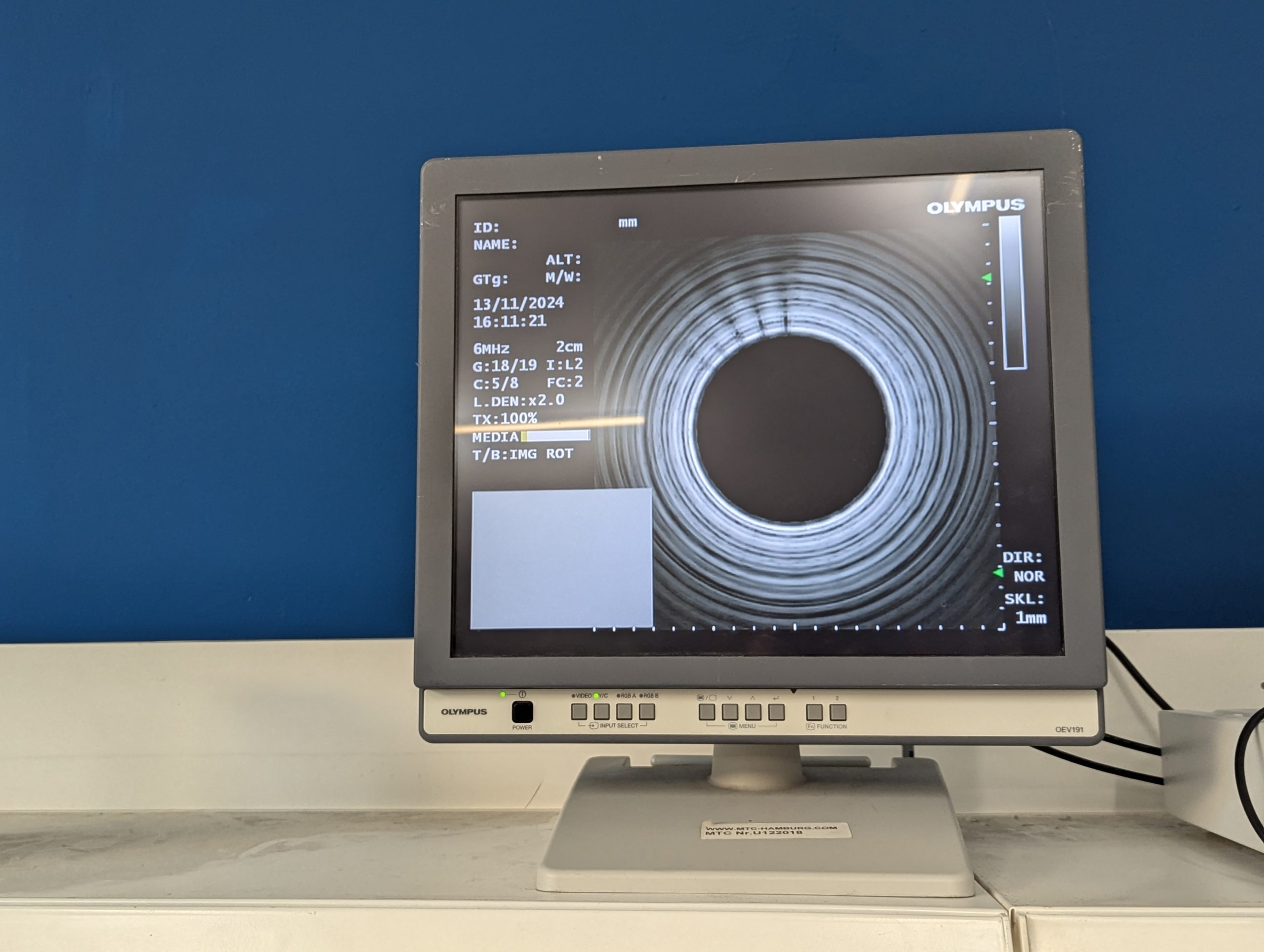 Olympus GF-UE160-AL5 Gastroskop Ultraschall Gastroskope - GEPRÜFT – Bild 21