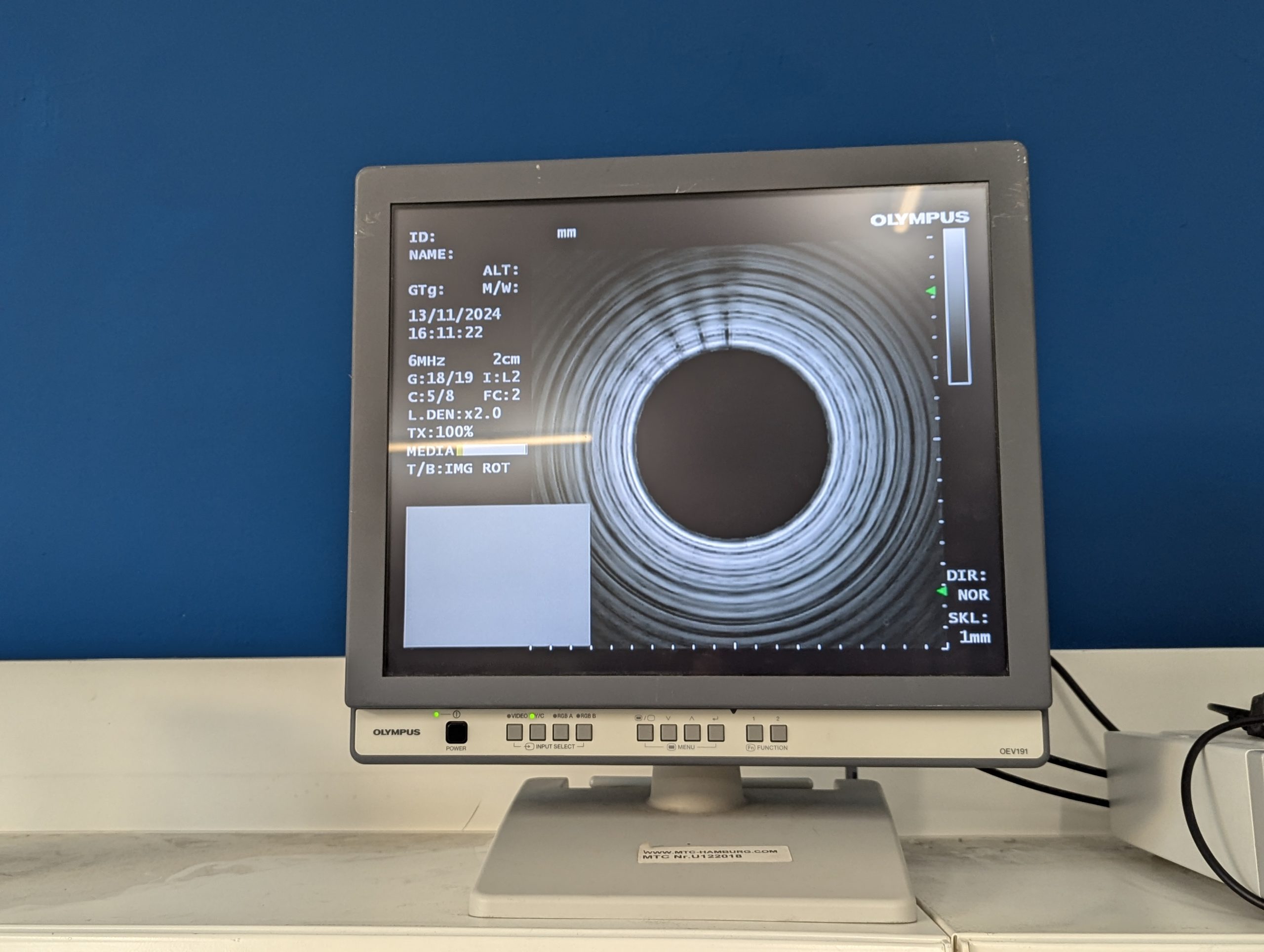 Olympus GF-UE160-AL5 Gastroskop Ultraschall Gastroskope - GEPRÜFT – Bild 22