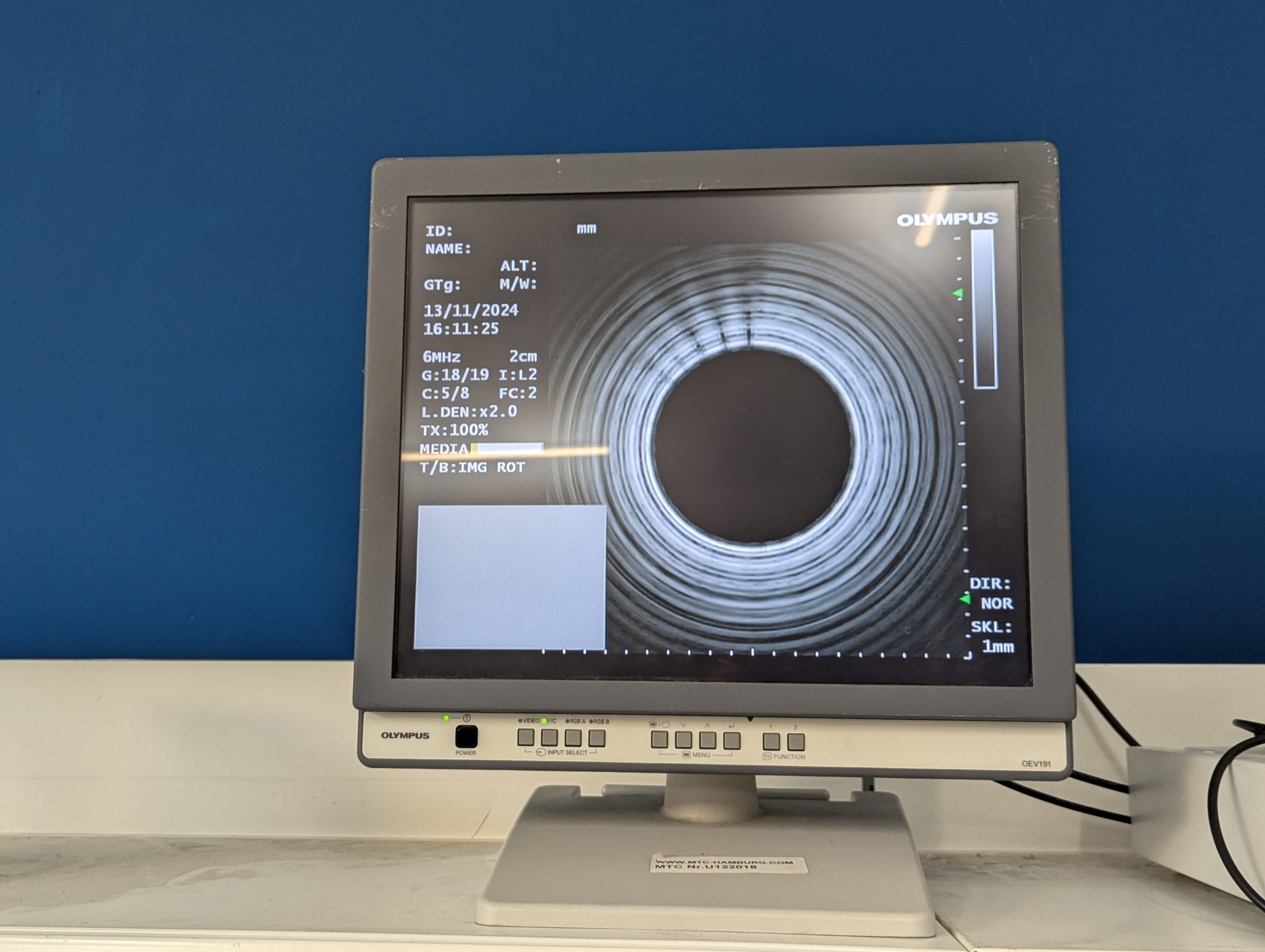 Olympus GF-UE160-AL5 Gastroskop Ultraschall Gastroskope - GEPRÜFT – Bild 23