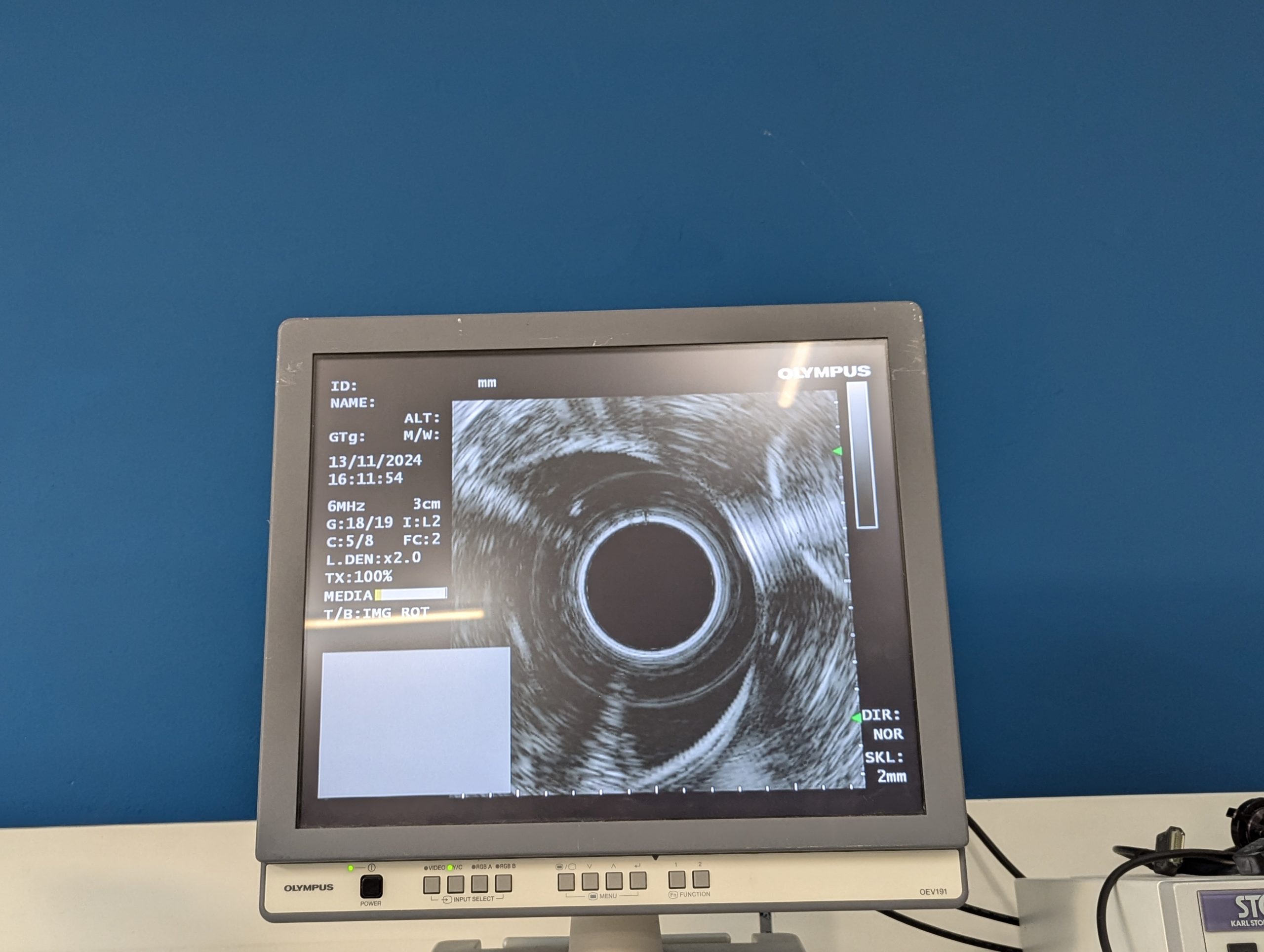 Olympus GF-UE160-AL5 Gastroskop Ultraschall Gastroskope - GEPRÜFT – Bild 25