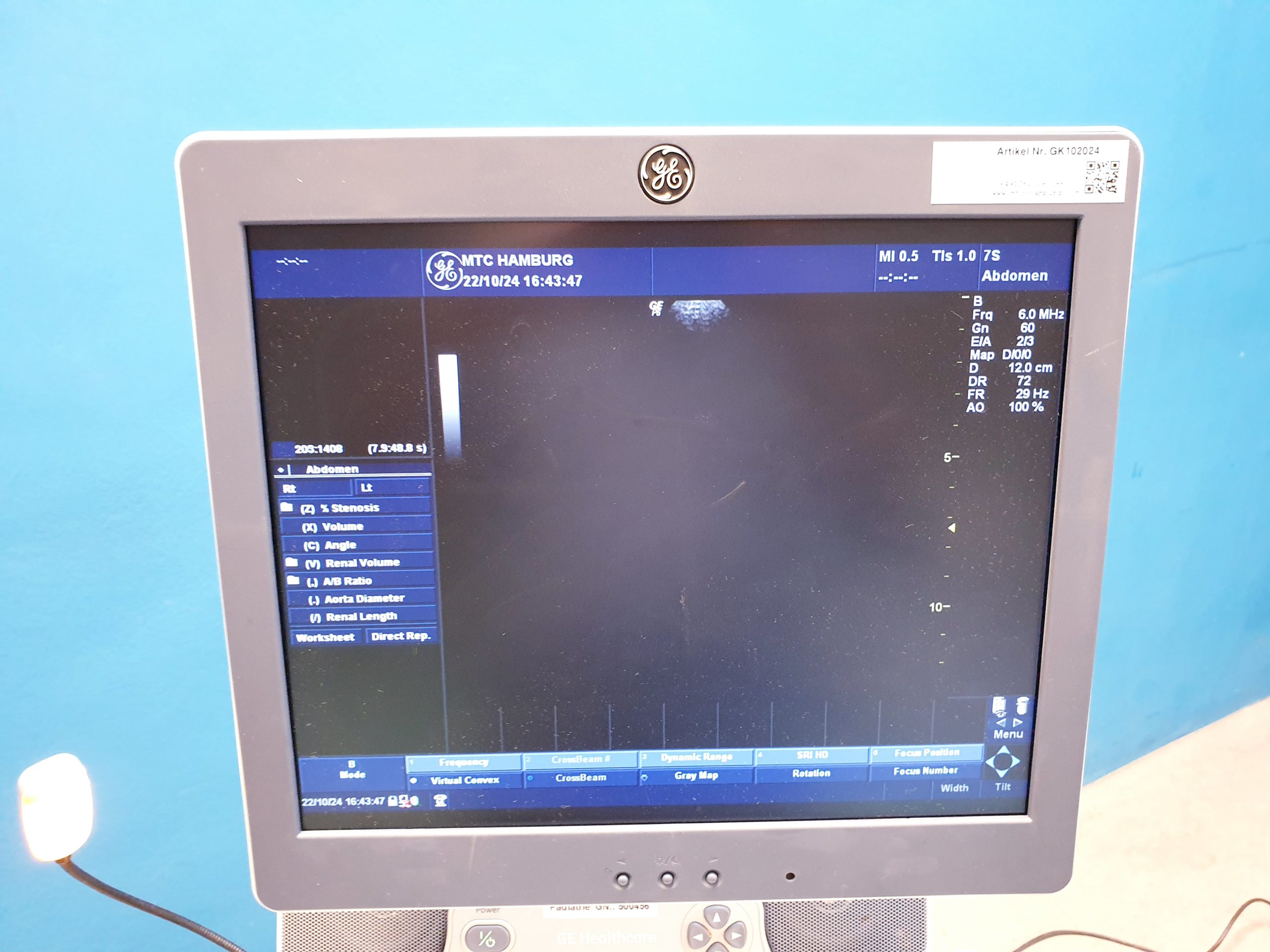 GE LOGIQ P6 Pro +4C+11 + 7S – Kardiomaschine – Bild 16