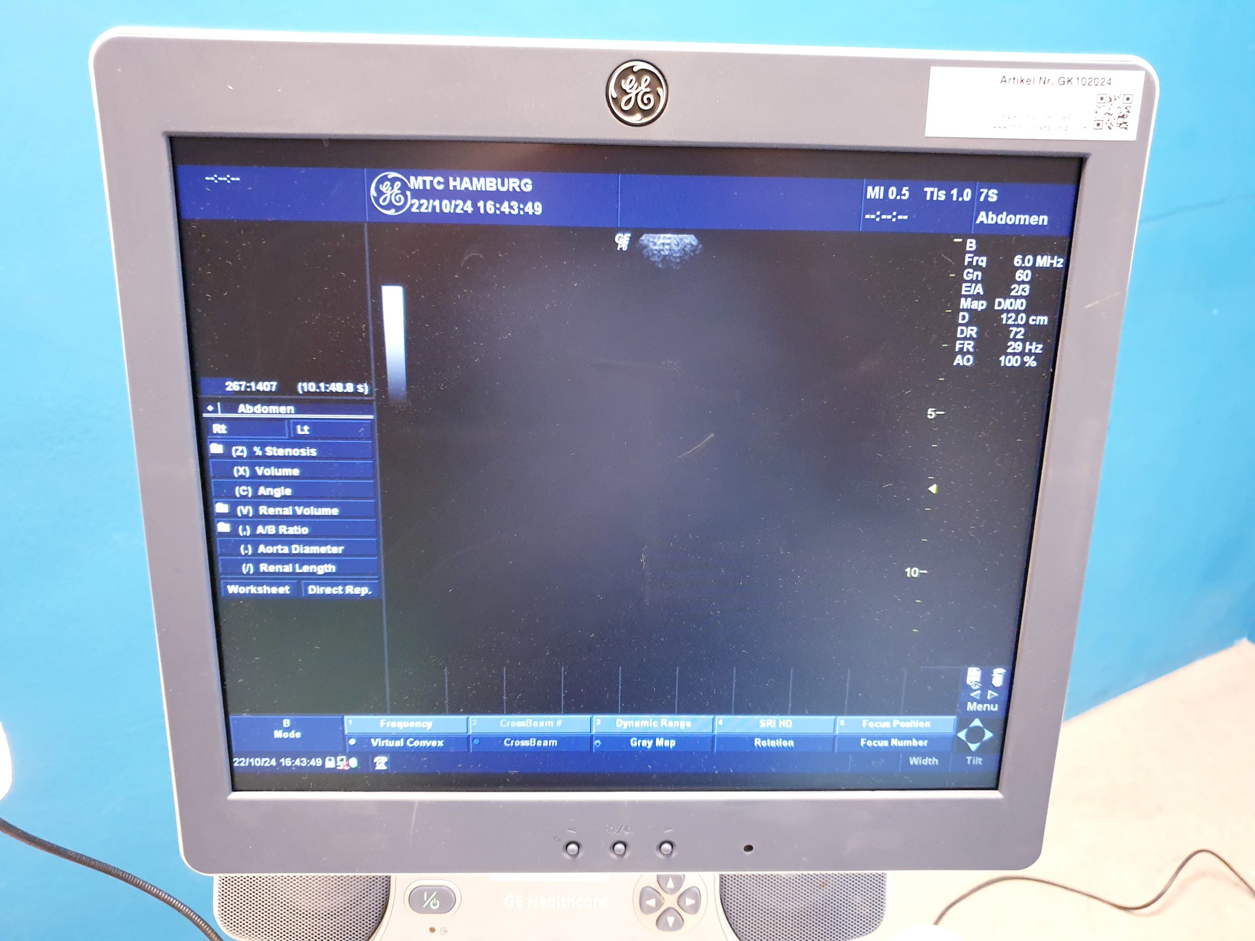 GE LOGIQ P6 Pro +4C+11 + 7S – Kardiomaschine – Bild 17