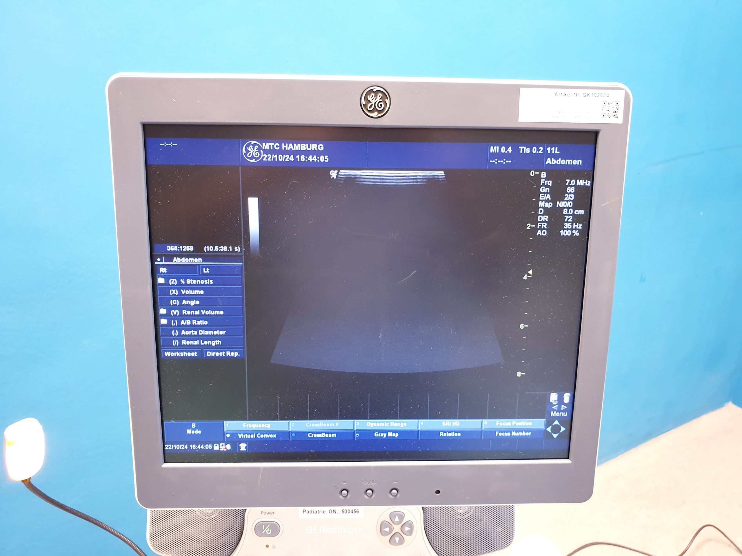 GE LOGIQ P6 Pro +4C+11 + 7S – Kardiomaschine – Bild 19